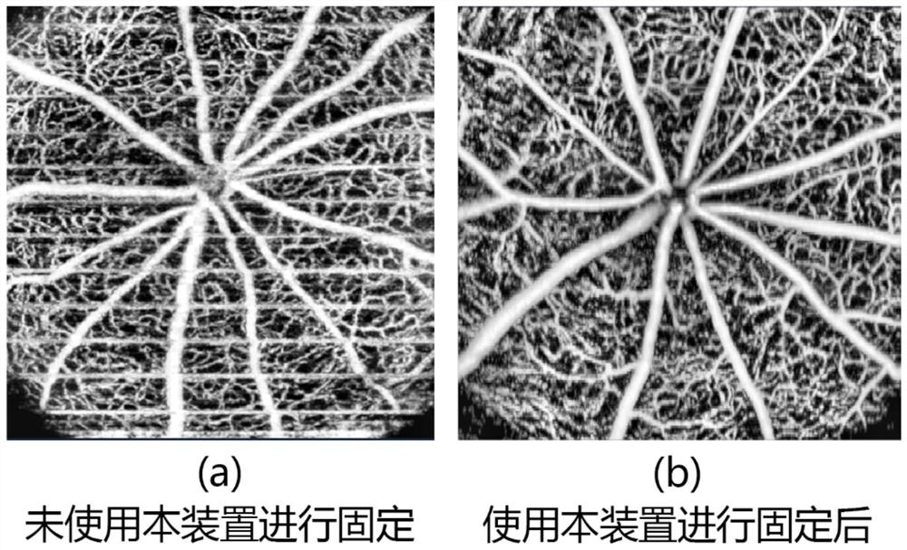 A mouse fixture for high-resolution detection experiments in ophthalmology