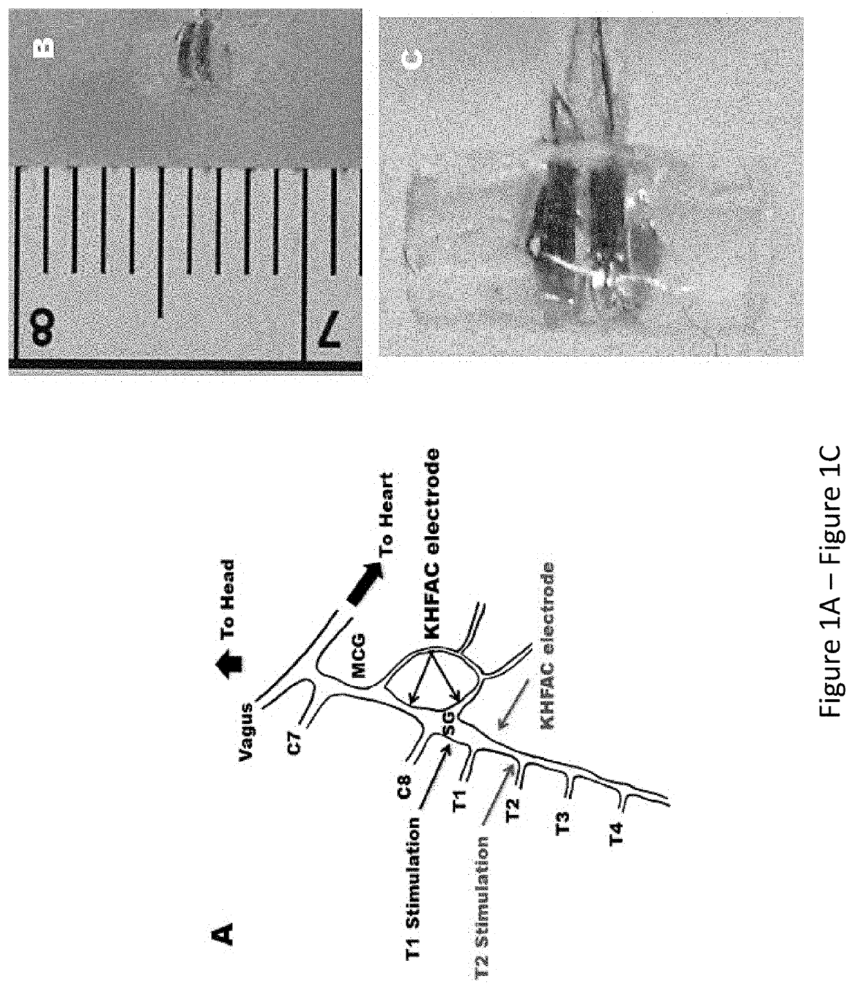 Neural modulation of autonomic nervous system to alter memory and plasticity of the autonomic network