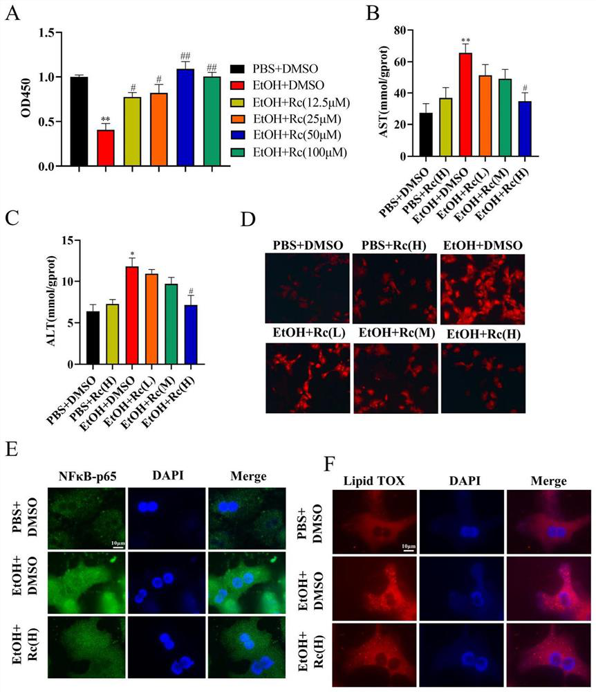 Application of ginsenoside Rc in preparation of medicine for treating alcoholic fatty liver