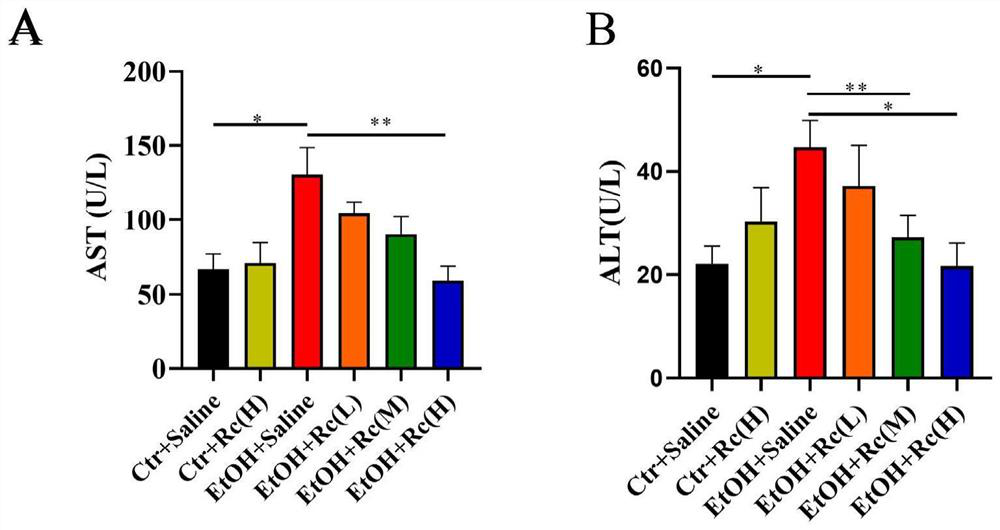 Application of ginsenoside Rc in preparation of medicine for treating alcoholic fatty liver