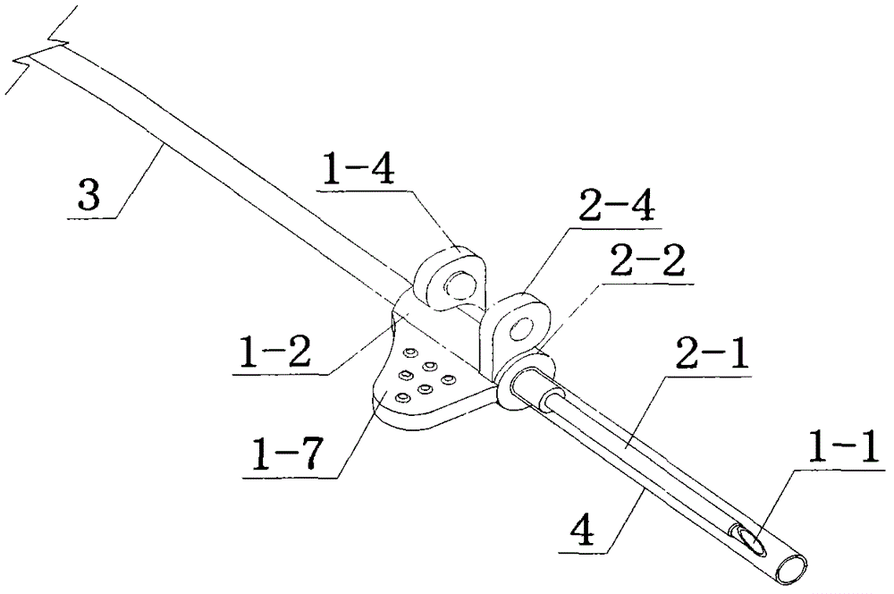 A disposable intravenous infusion safety needle