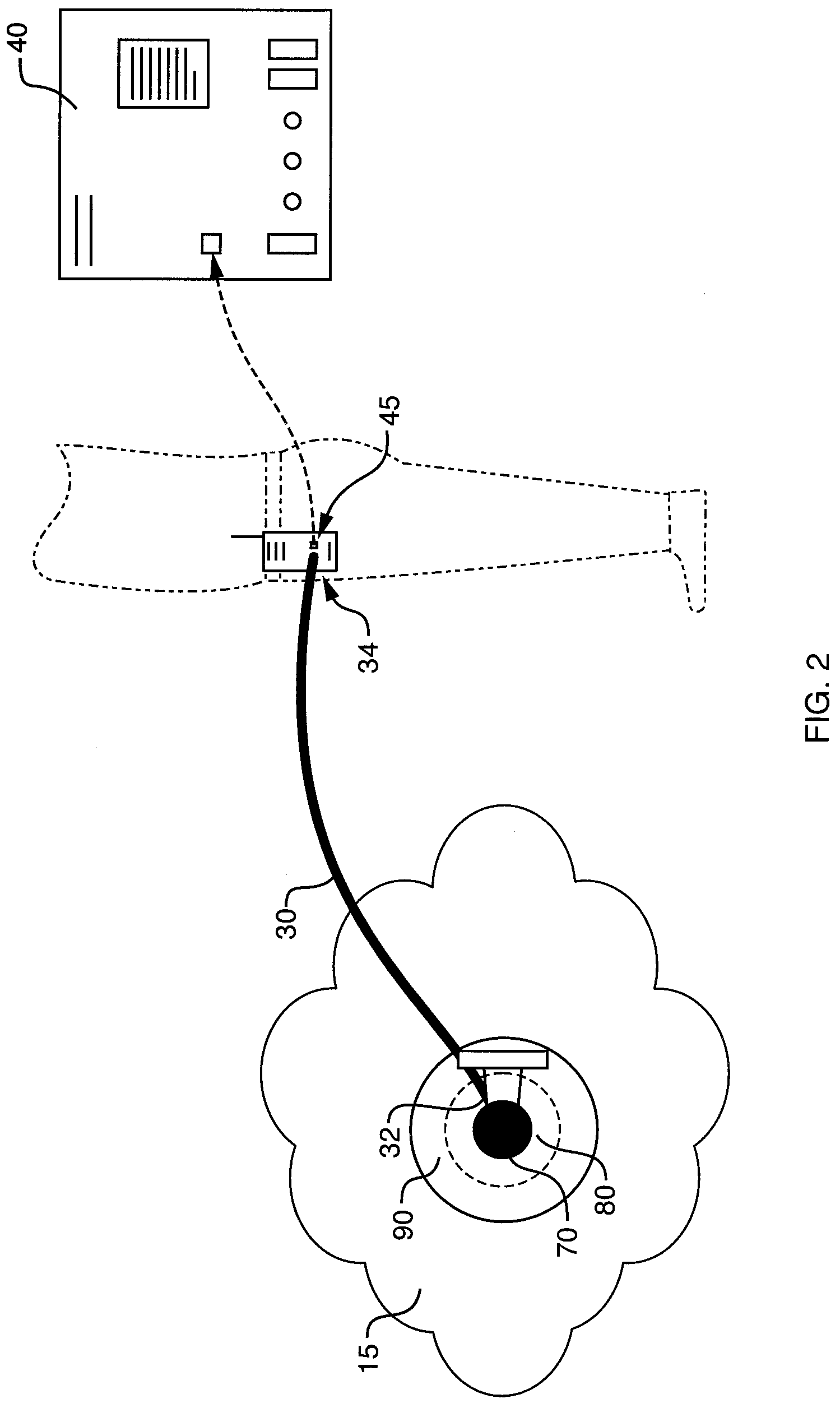 Electrode connection system