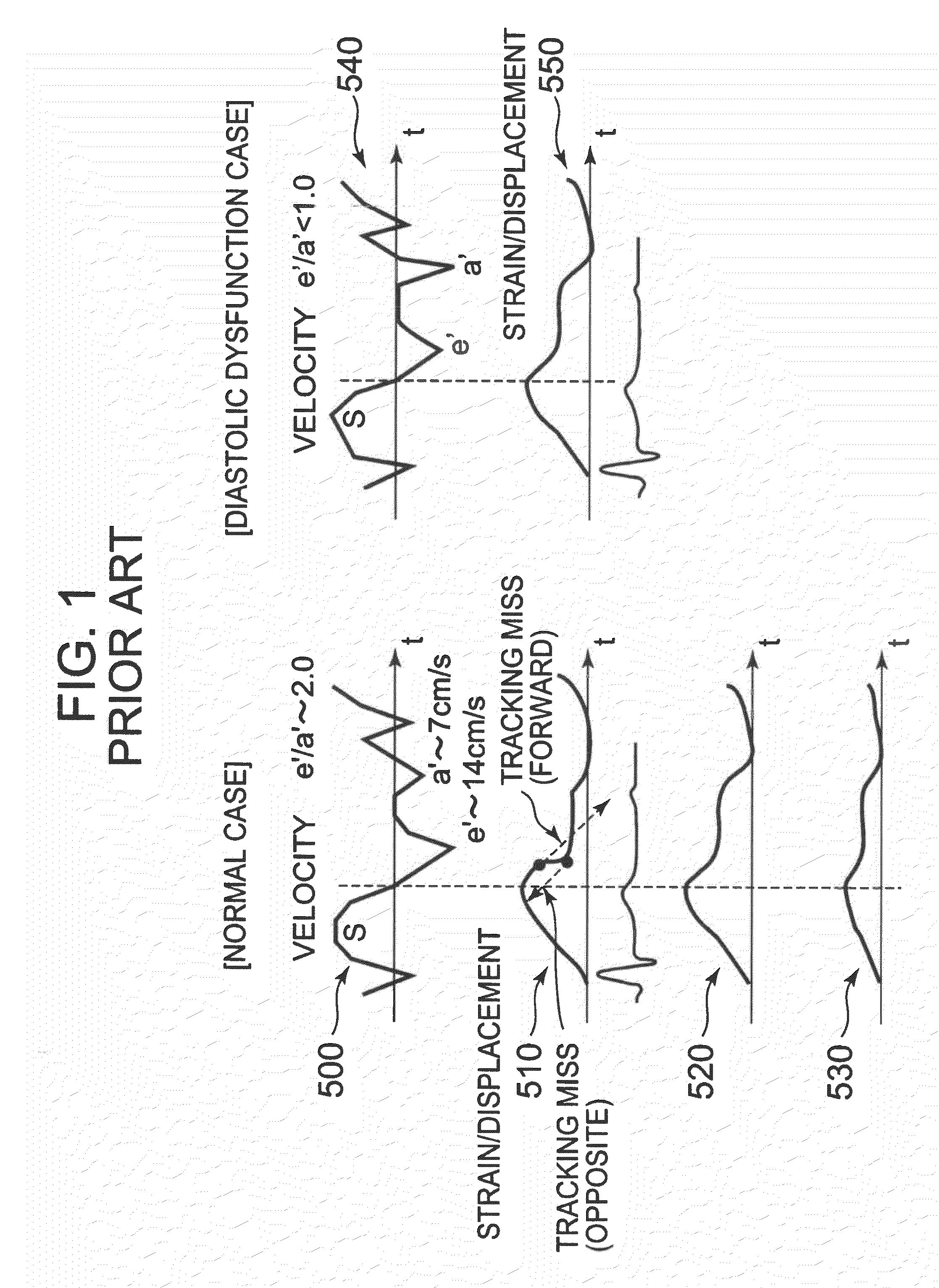 Ultrasound imaging apparatus and method for processing ultrasound image