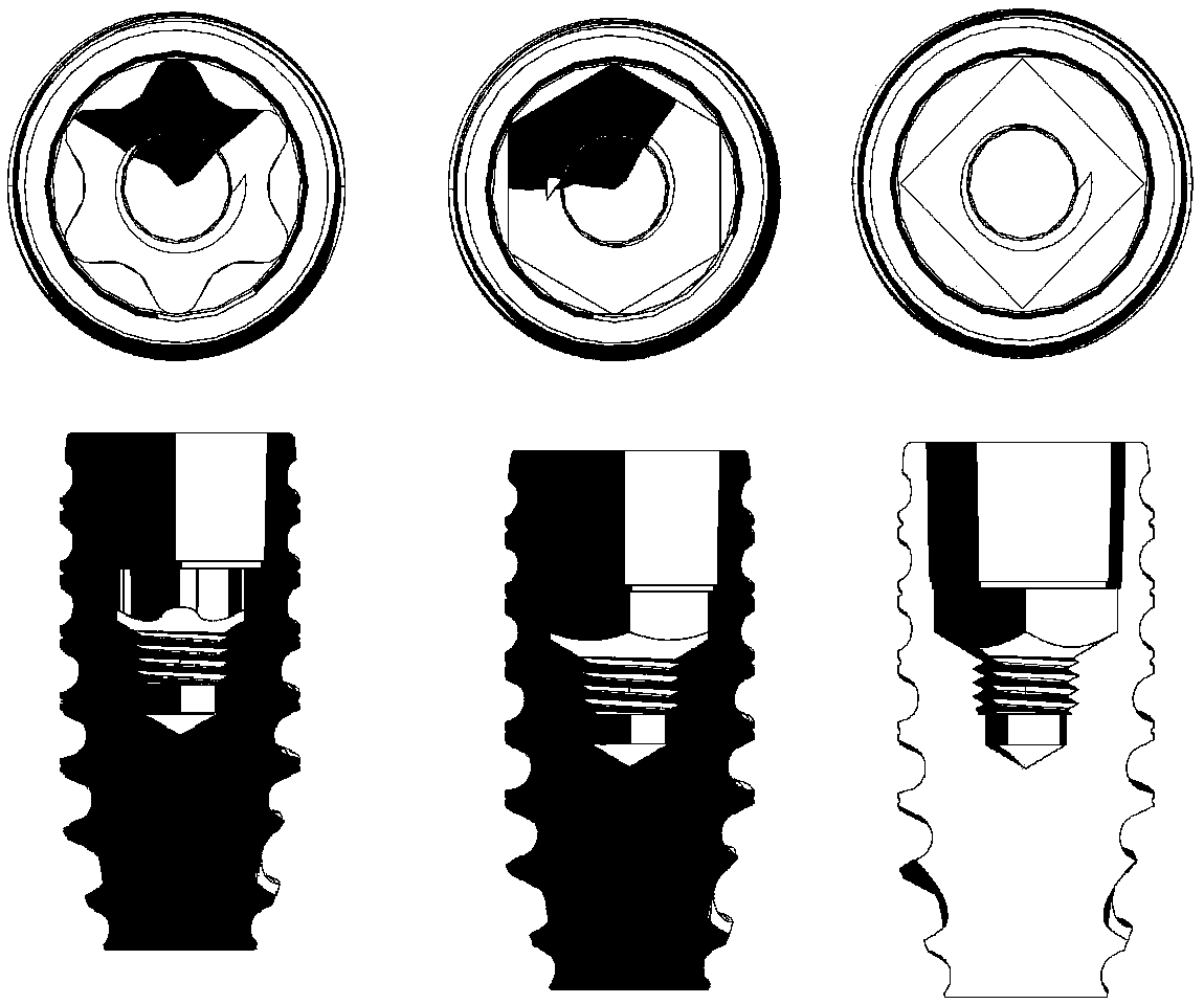 Dental implant system