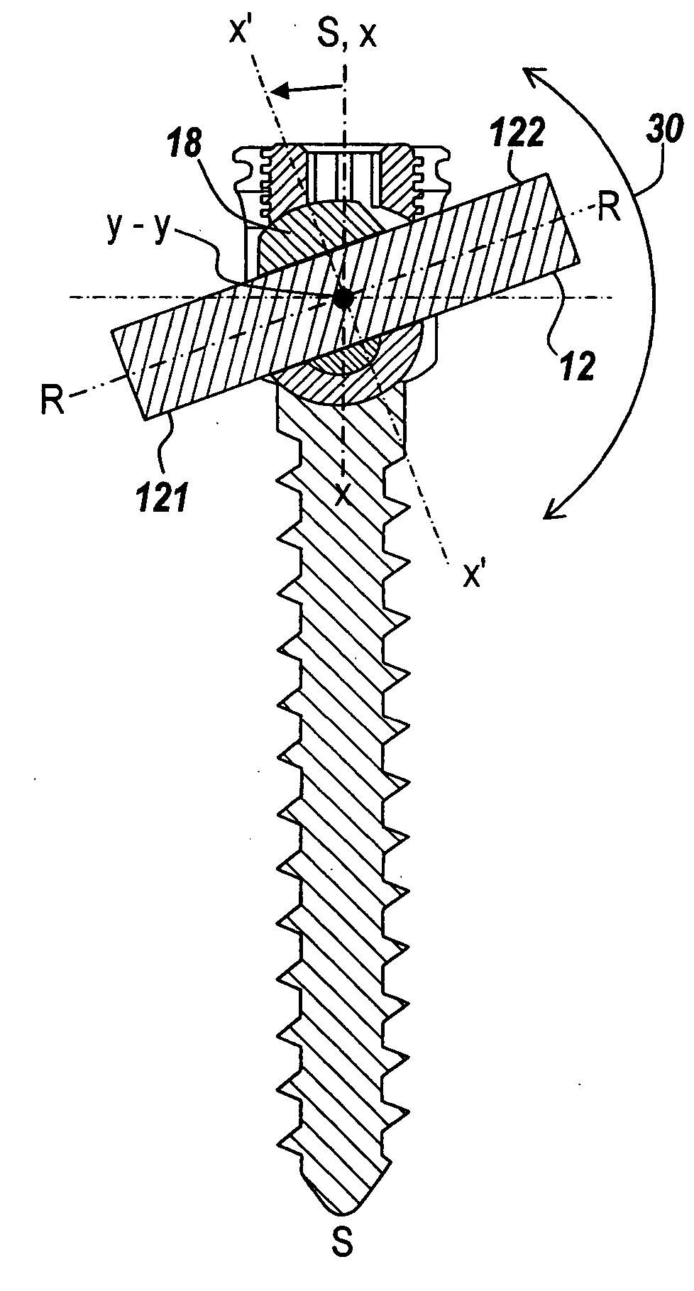 Adjustable bone screw assembly