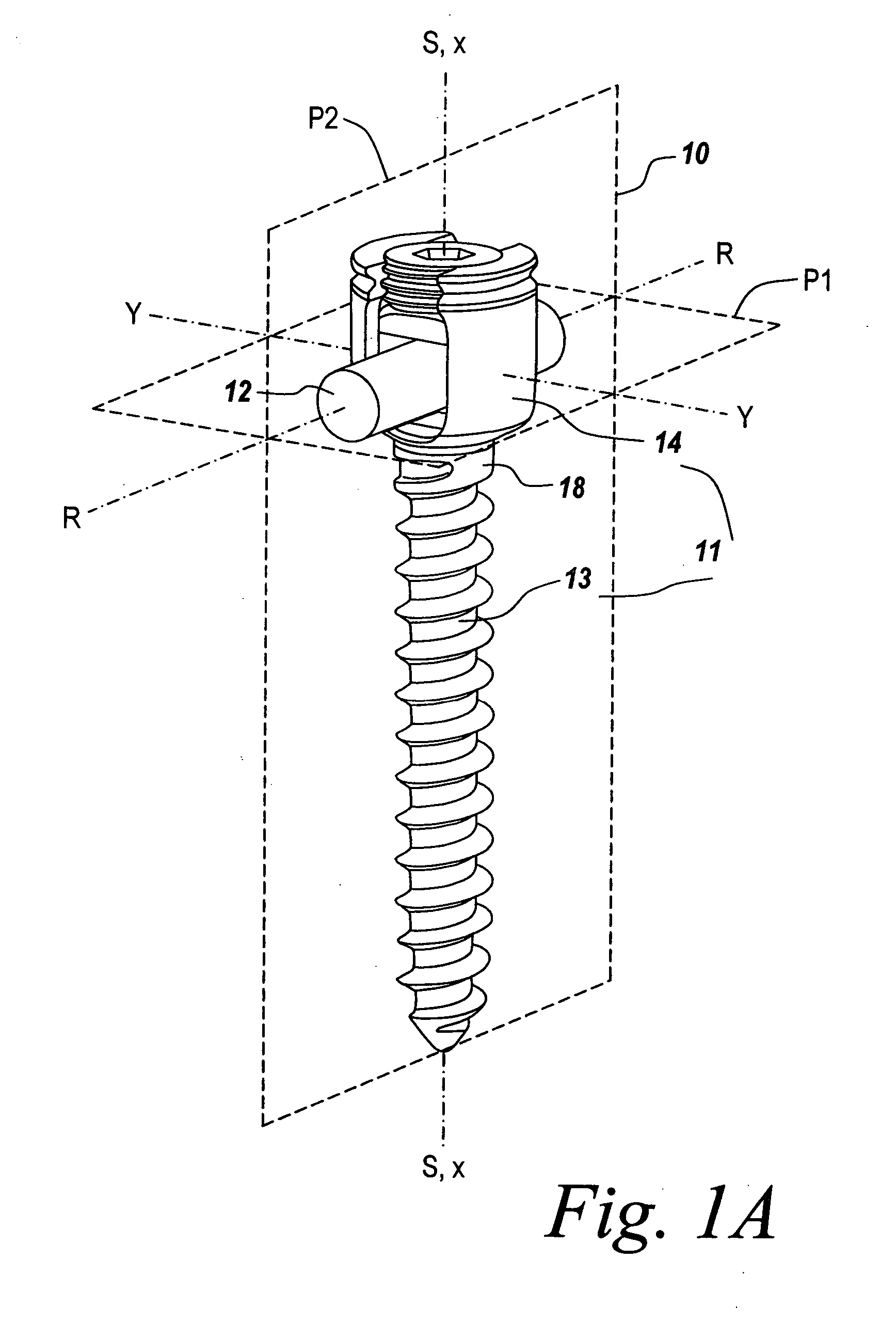 Adjustable bone screw assembly