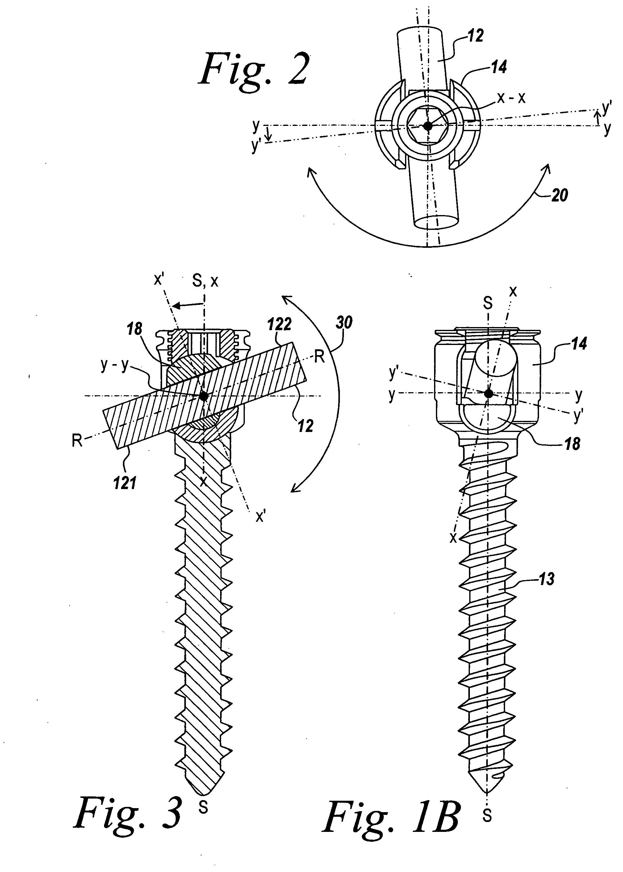 Adjustable bone screw assembly