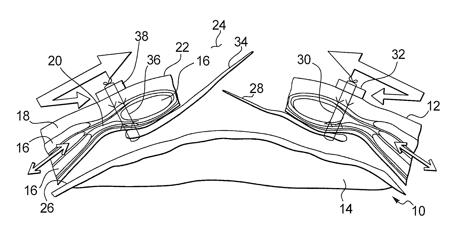 Method and apparatus for surgically closing an open abdomen