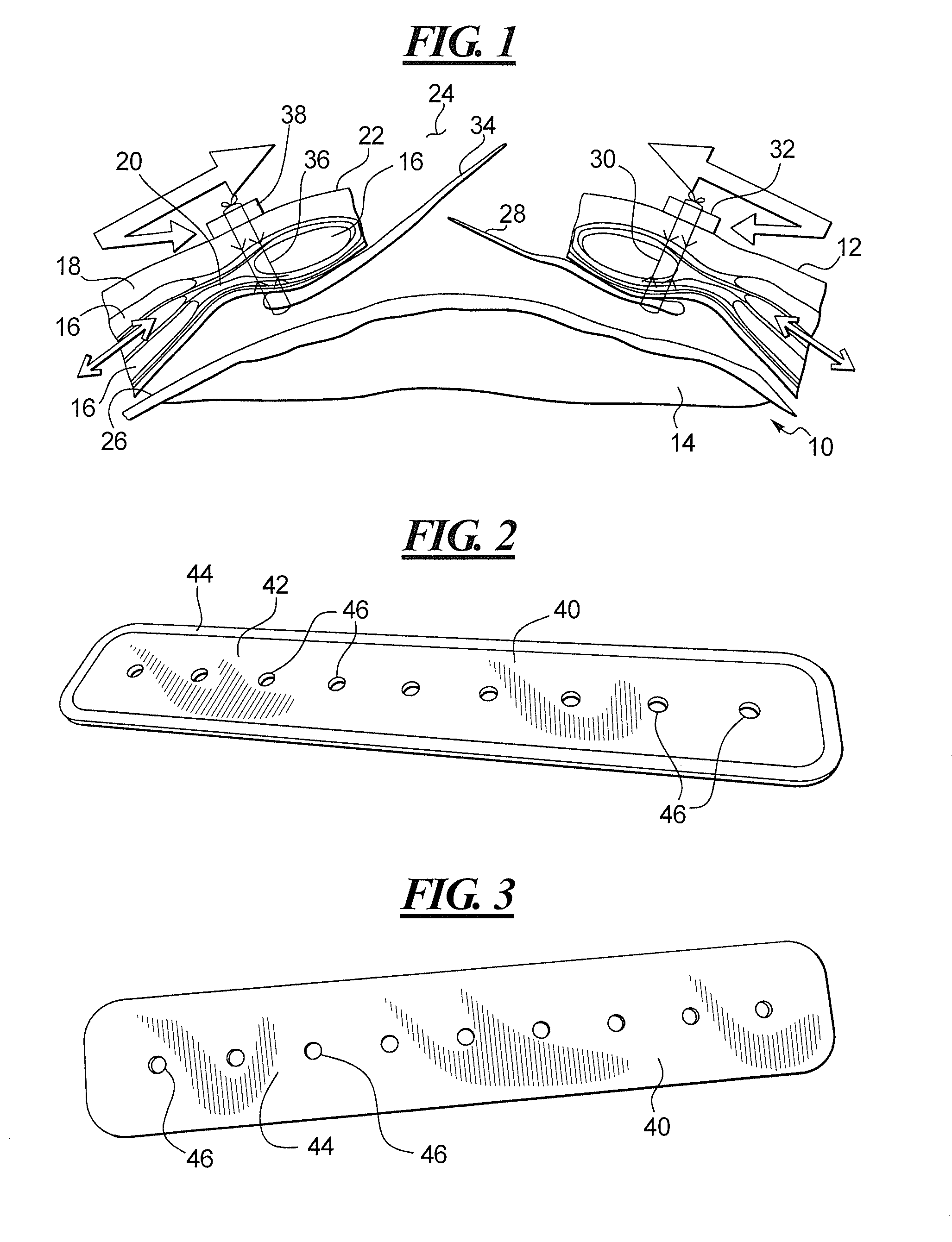 Method and apparatus for surgically closing an open abdomen