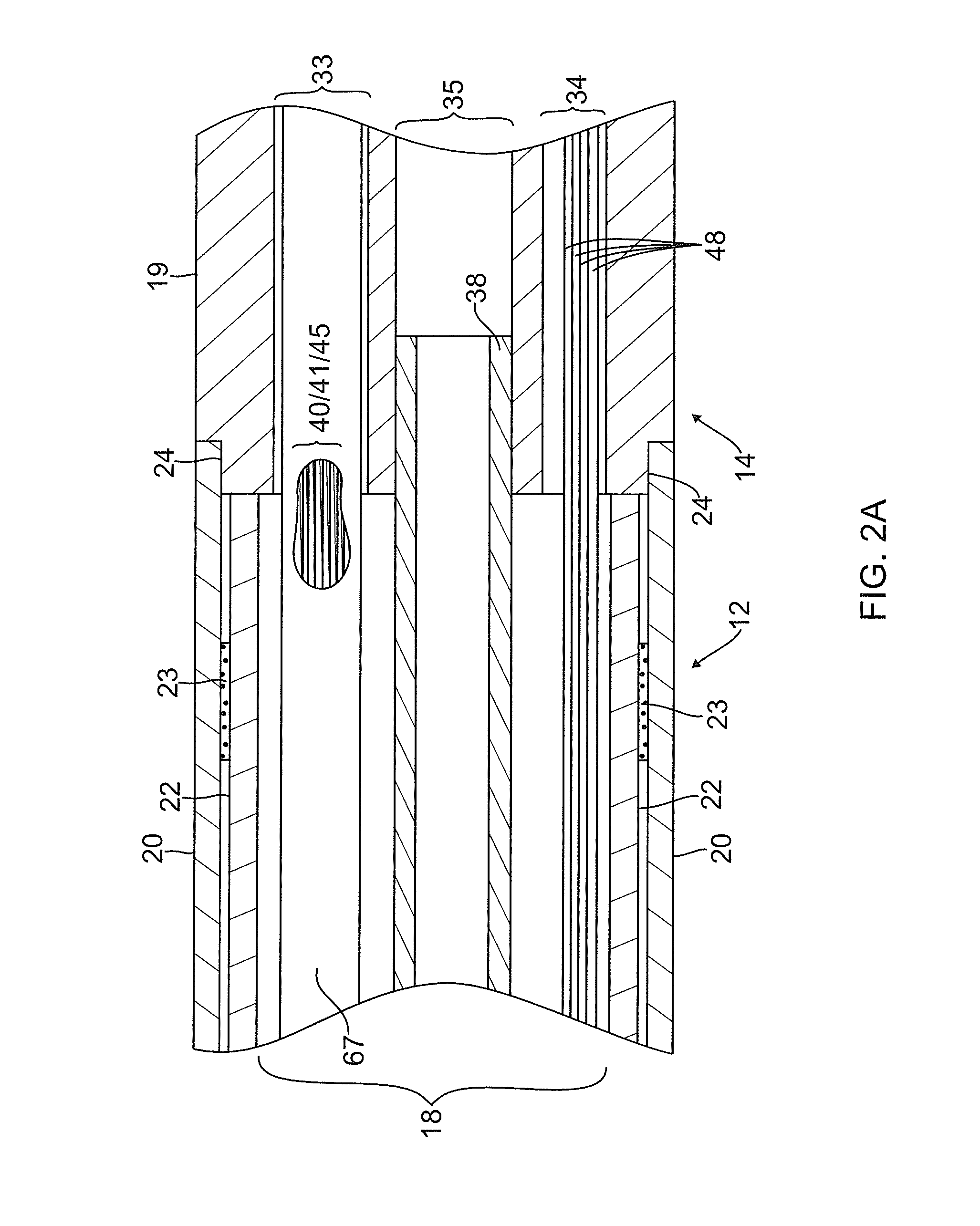 Catheter with composite construction