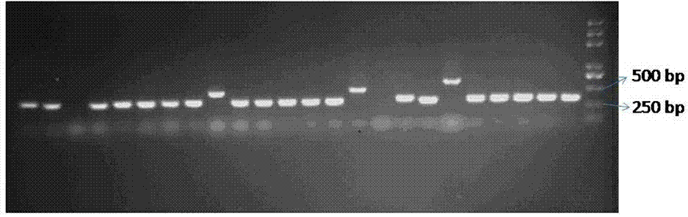 DNA aptamer of small cell lung cancer marker gastrin releasing peptide precursor polypeptide fragment