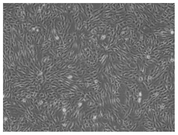 Method for extracting paracrine factor from adipose-derived stem cells