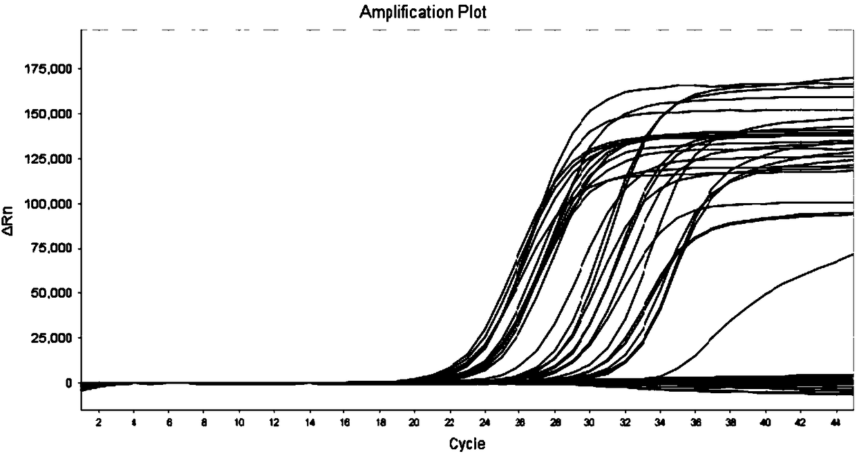 Molecular reagent for screening bladder cancer by using urine