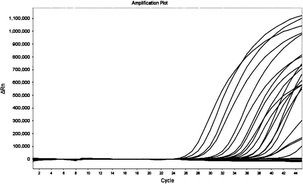 Molecular reagent for screening bladder cancer by using urine