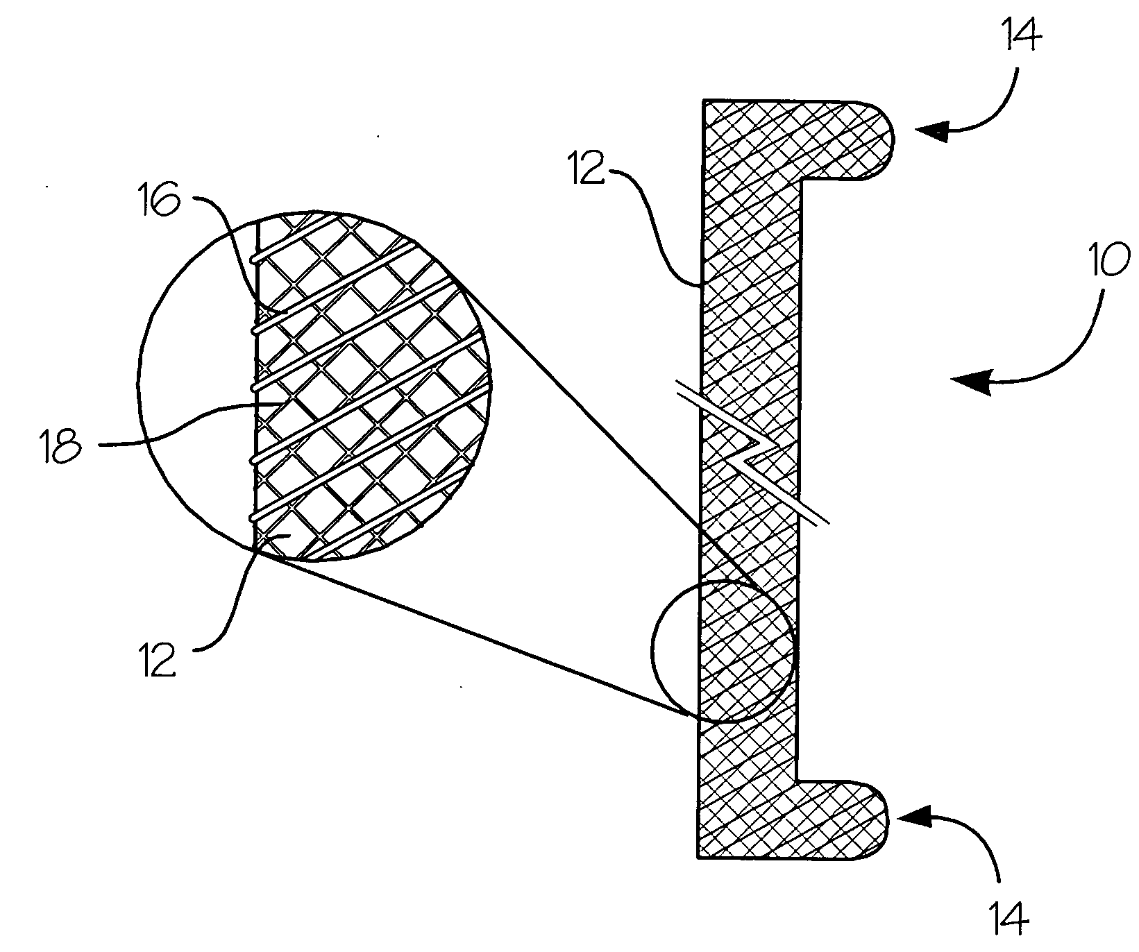 Fiber-reinforced composite absorbable endoureteral stent