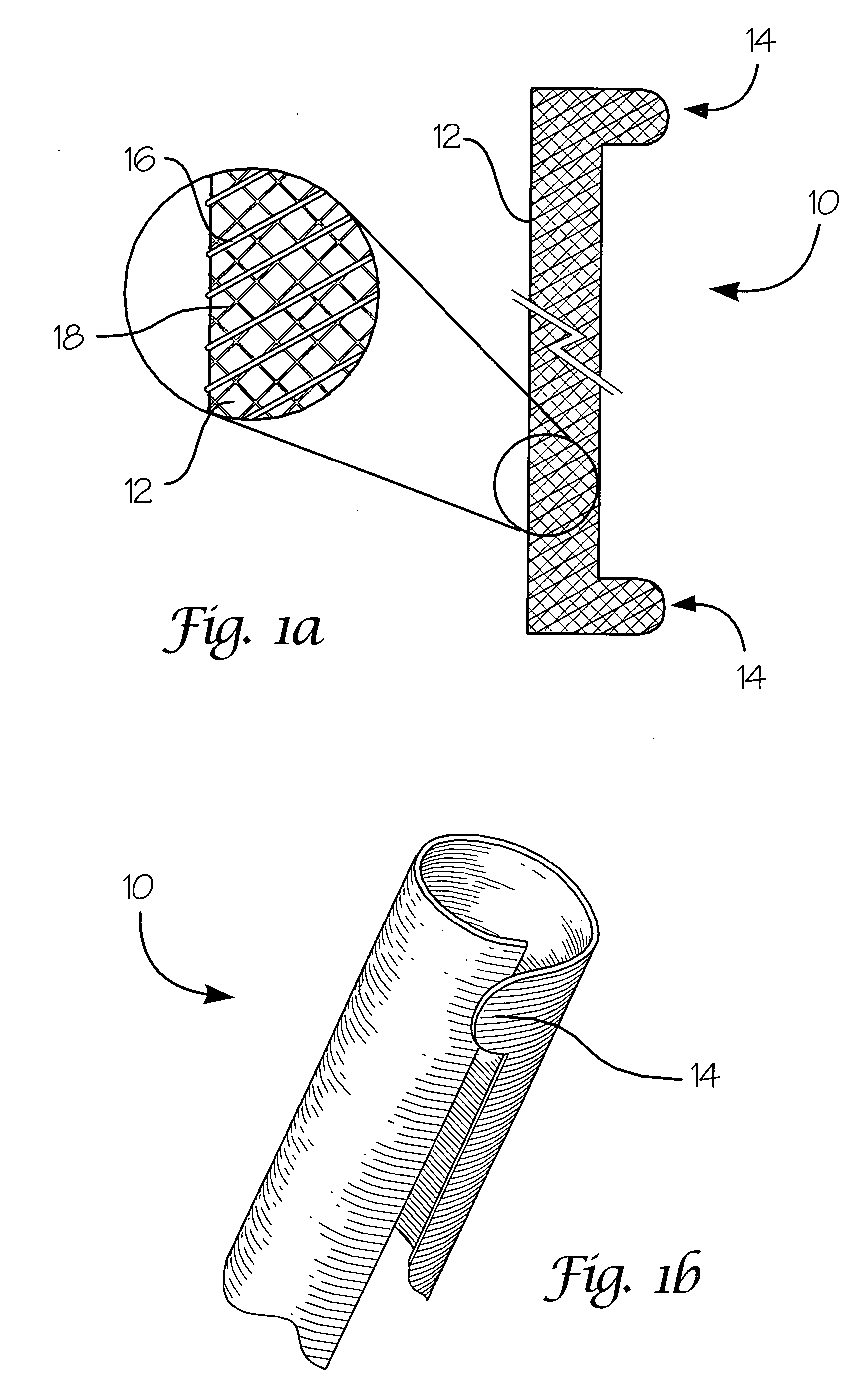 Fiber-reinforced composite absorbable endoureteral stent