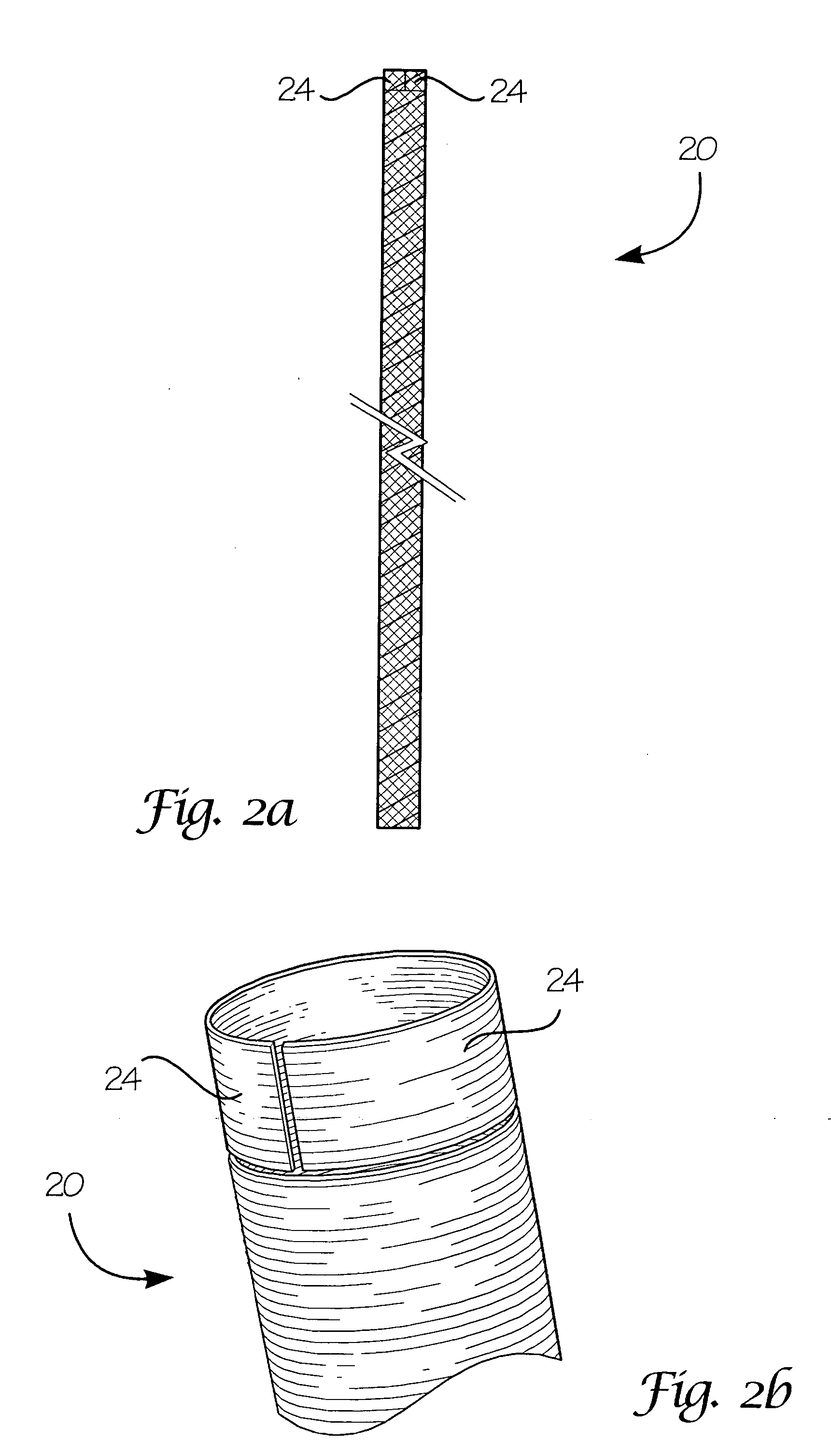 Fiber-reinforced composite absorbable endoureteral stent