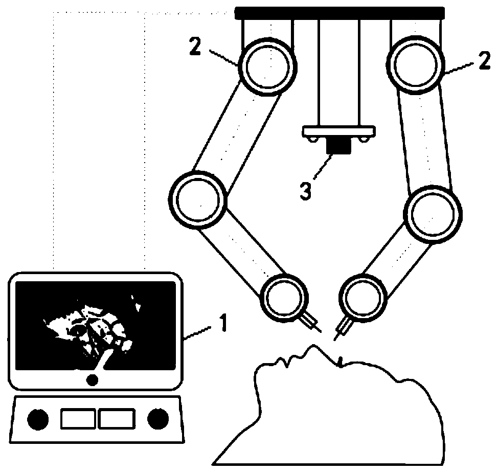 Ophthalmologic operation intelligent control system