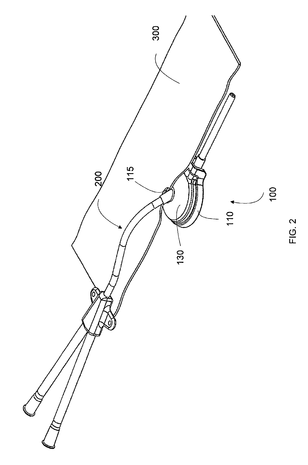 Deformable medical implant