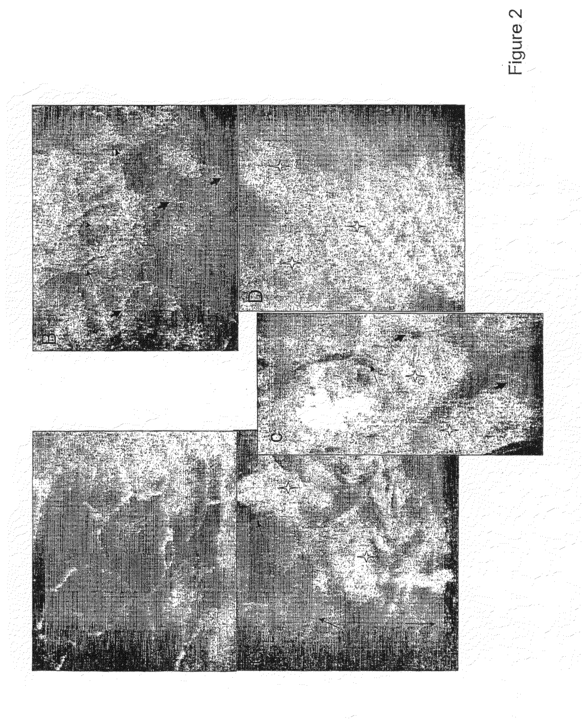 Modulating Retinal Pigmented Epithelium Permeaion By Inhibiting Or Activating VEGFR-1