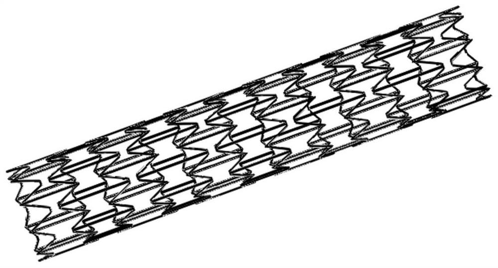 Stent suitable for urethral bent part