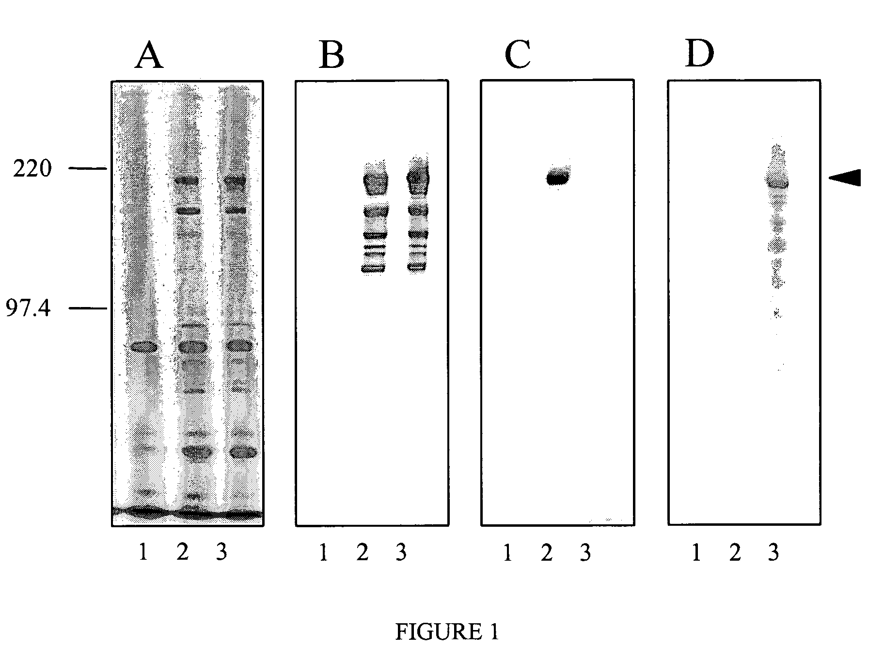 Lactic acid bacteria as agents for treating and preventing allergy