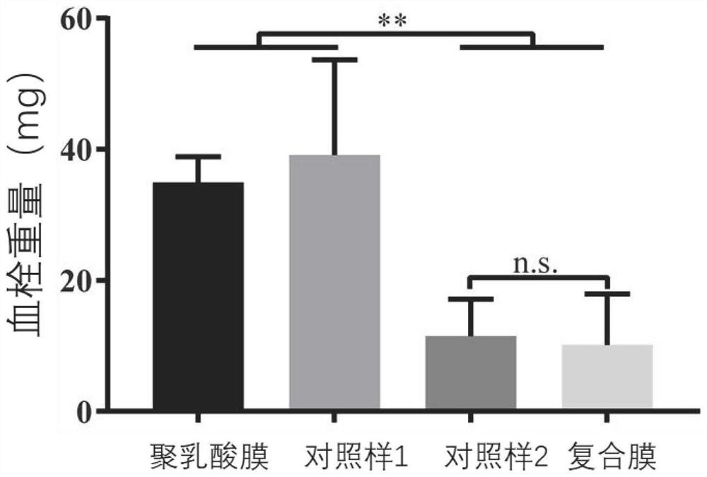 Degradable composite film for heart occluder as well as preparation method and application of degradable composite film