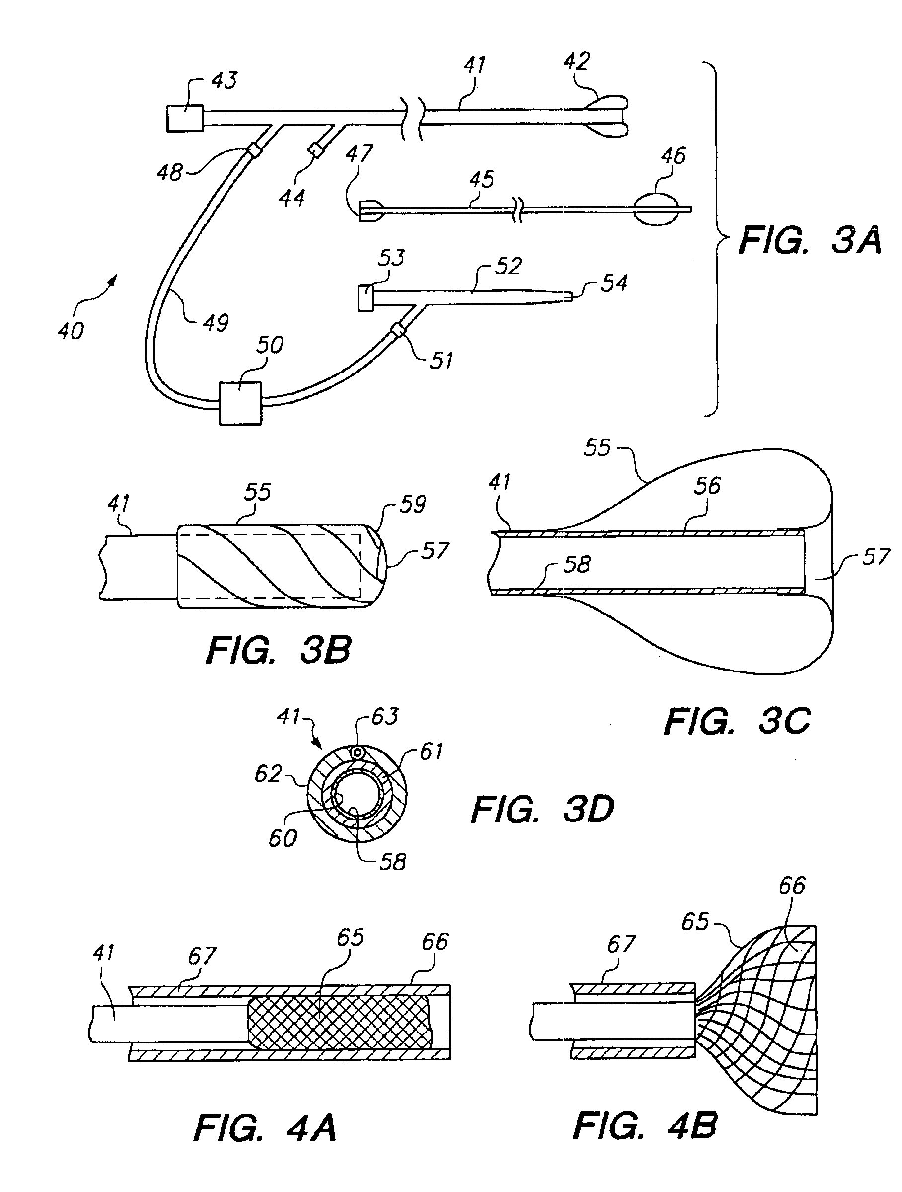 Apparatus and methods for reducing embolization during treatment of carotid artery disease