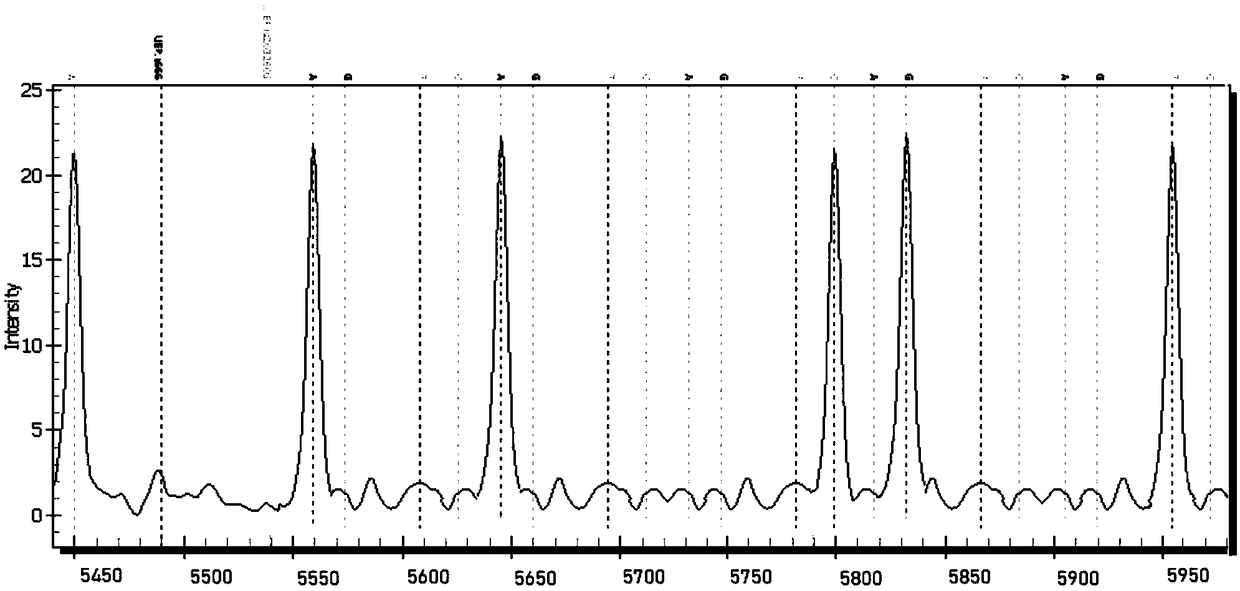 Method and kit for detecting human arthrolithiasis-related gene mutation sites