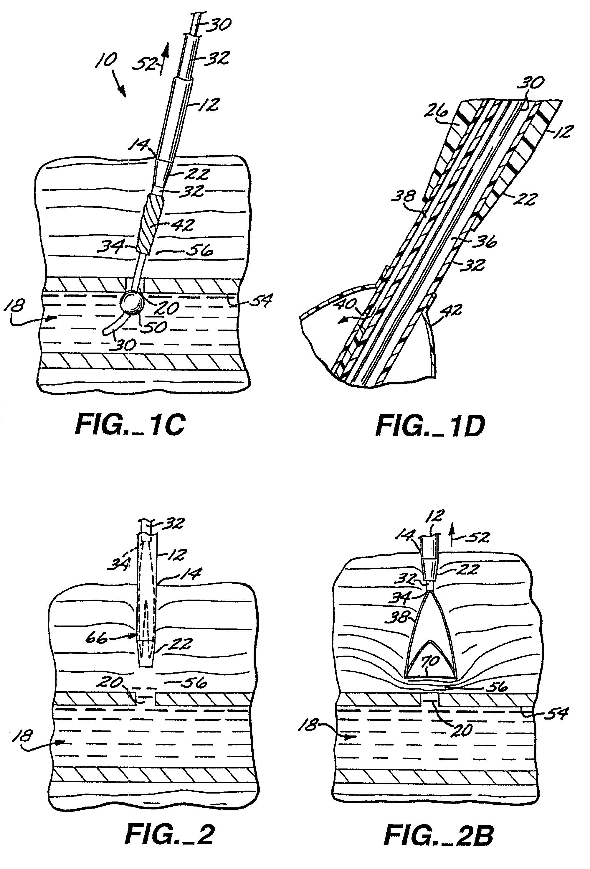 Apparatus and method for percutaneous sealing of blood vessel punctures