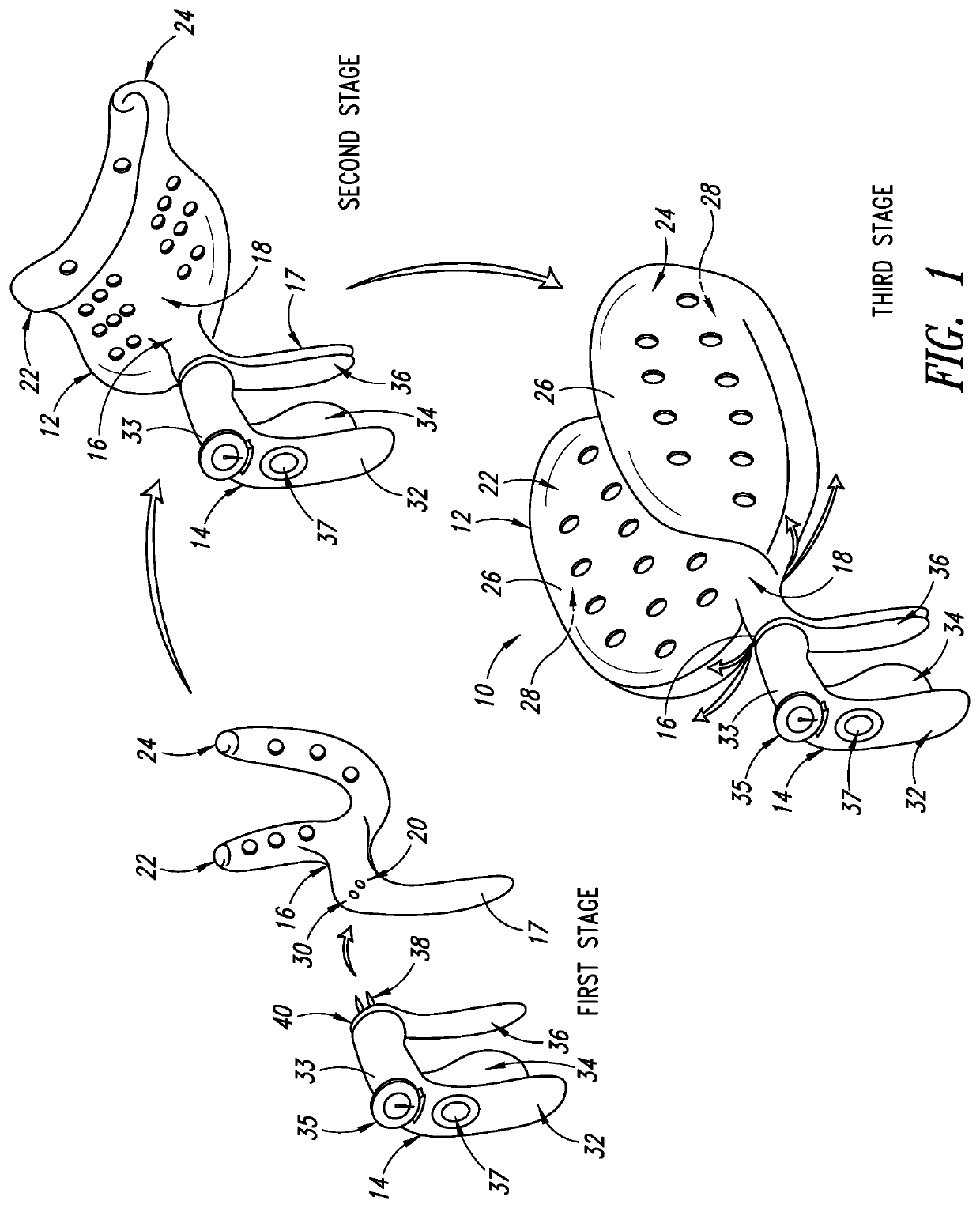 Method of protecting the pelvic floor during vaginal childbirth