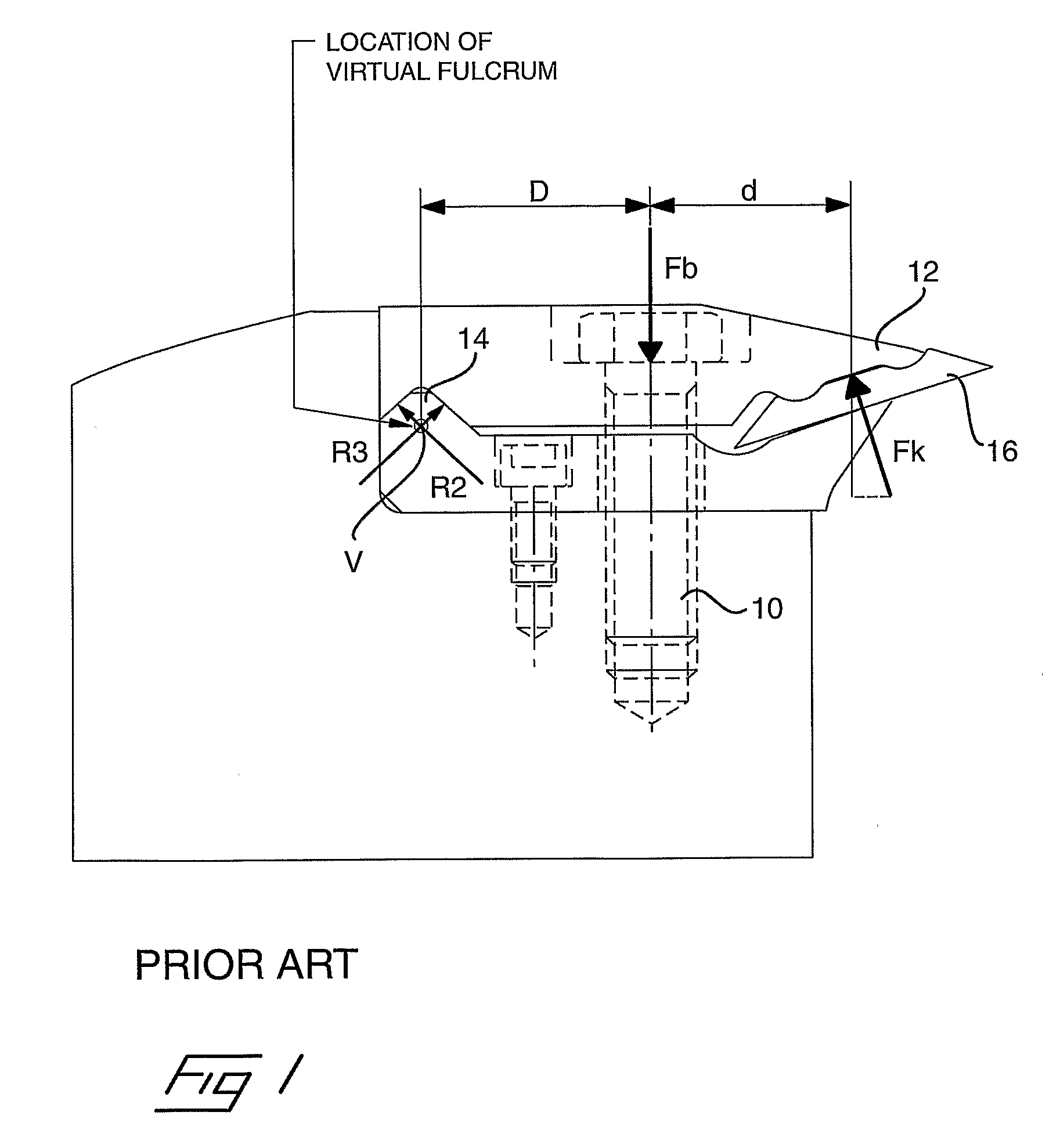 Clamping Assembly for Woodworking Knife