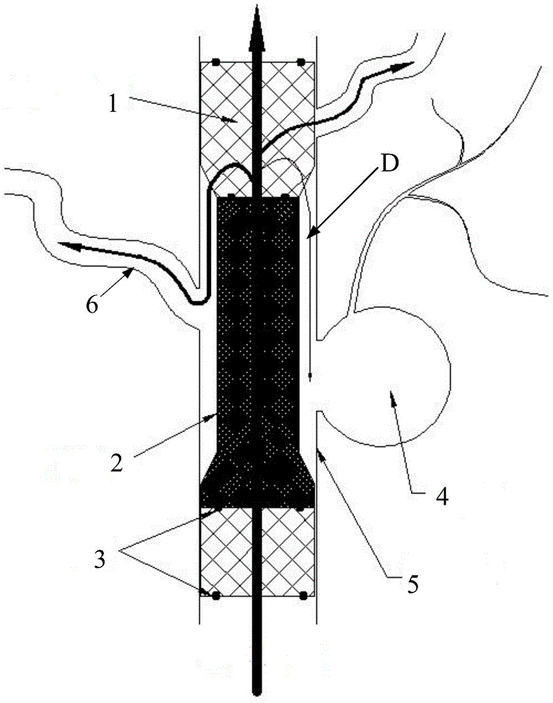 Cerebral aneurysm endovascular reconstruction device