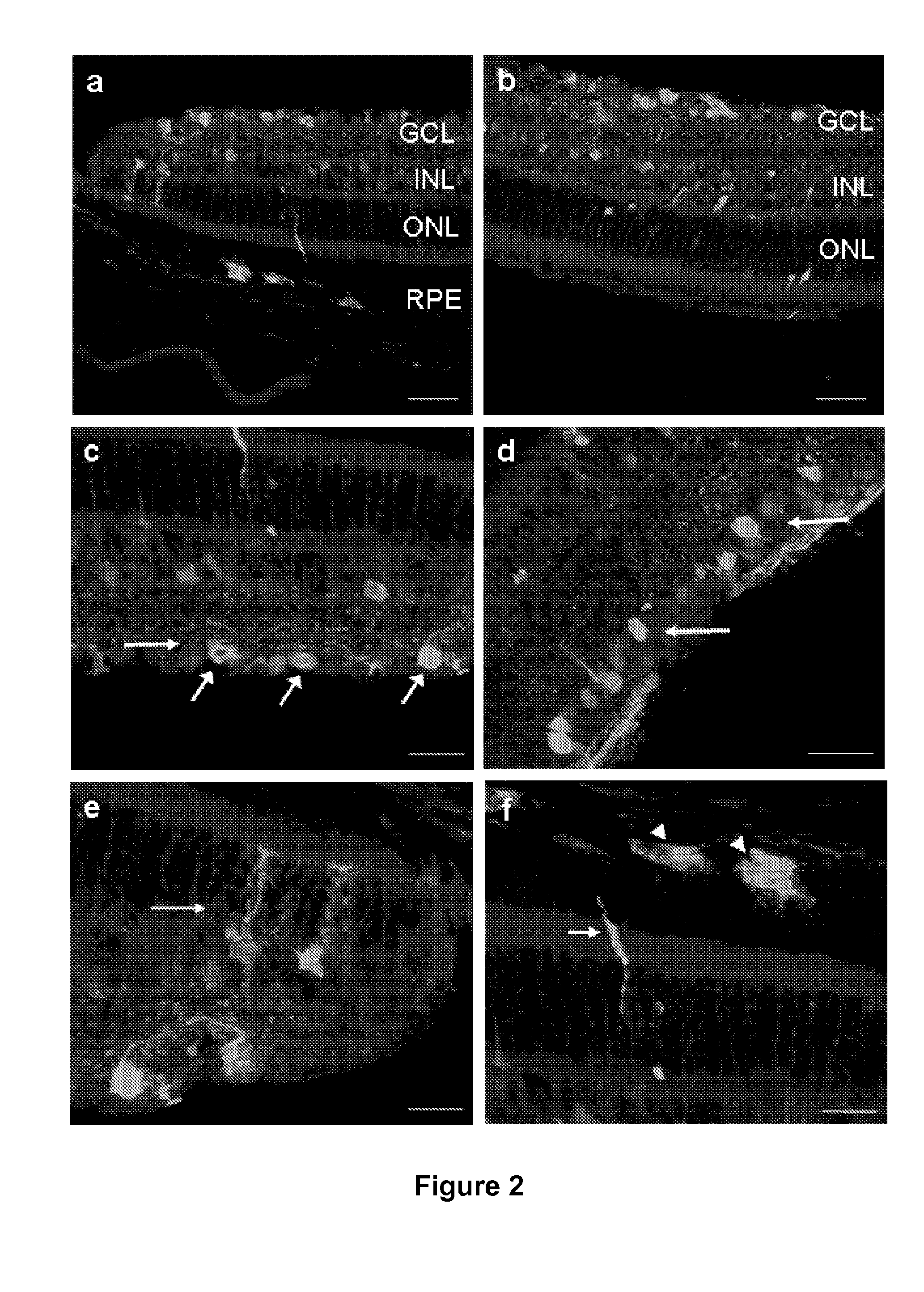 Widespread gene delivery to the retina using systemic administration of aav vectors