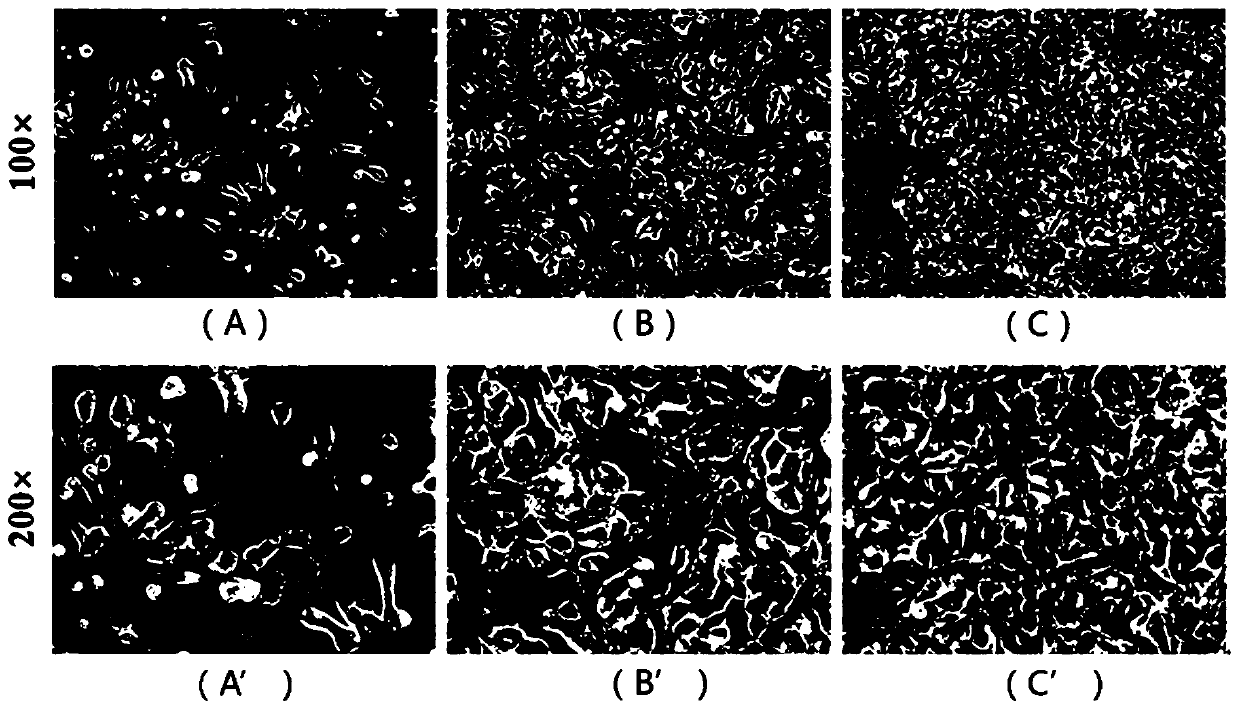 Human Ewing's sarcoma cell line