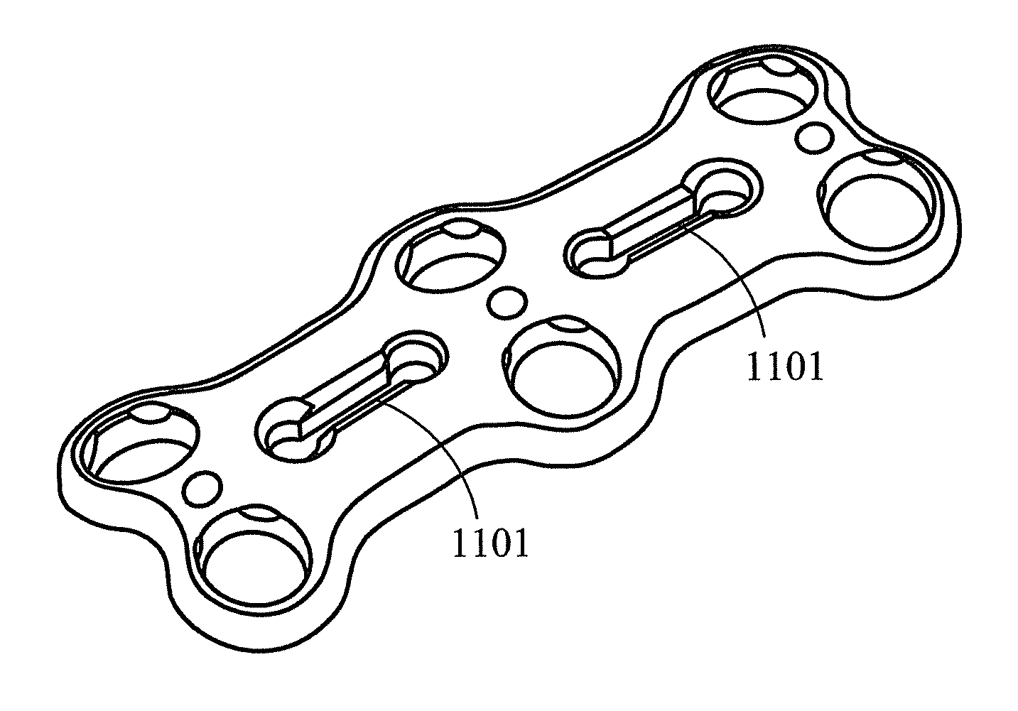 Bone fixation plate