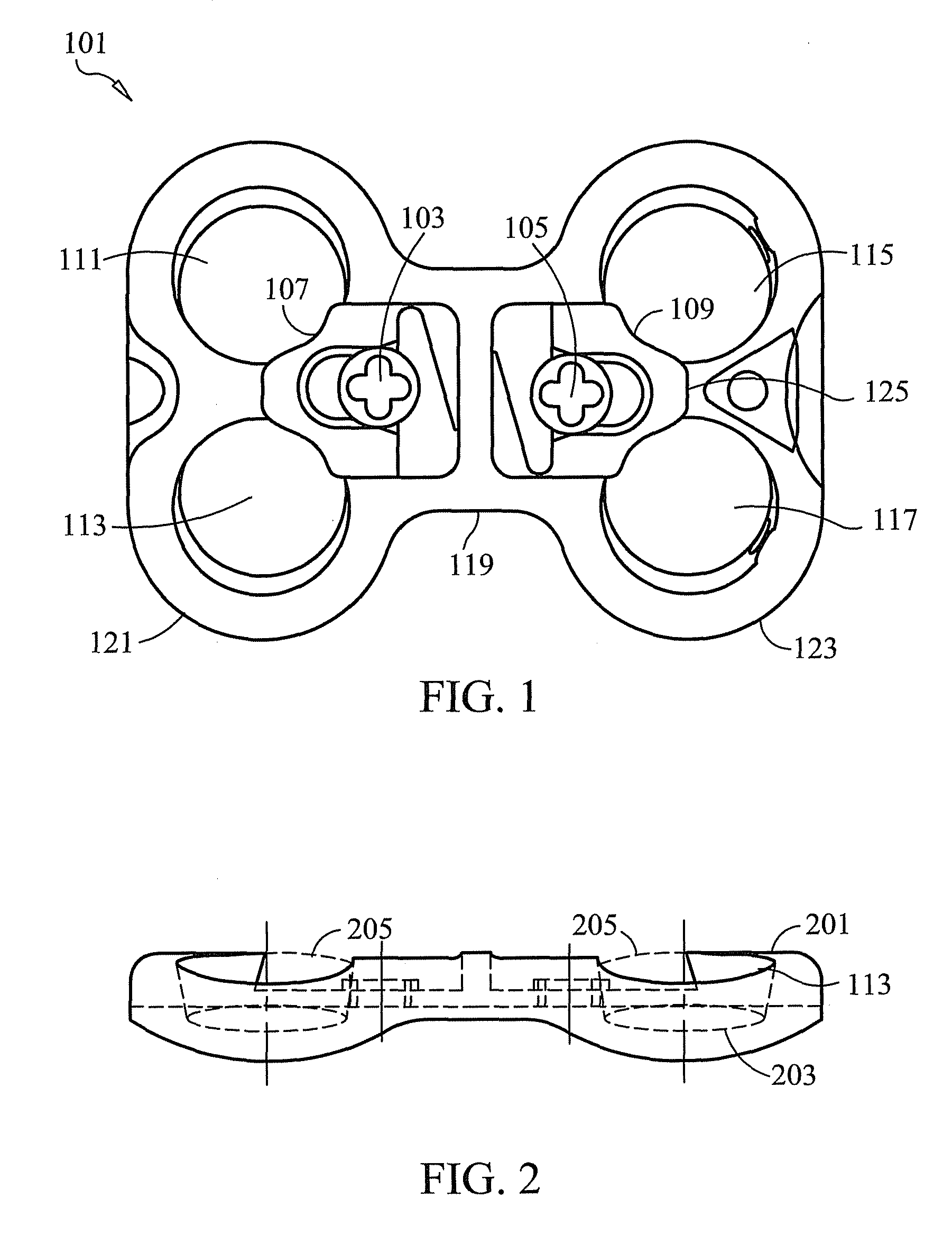 Bone fixation plate