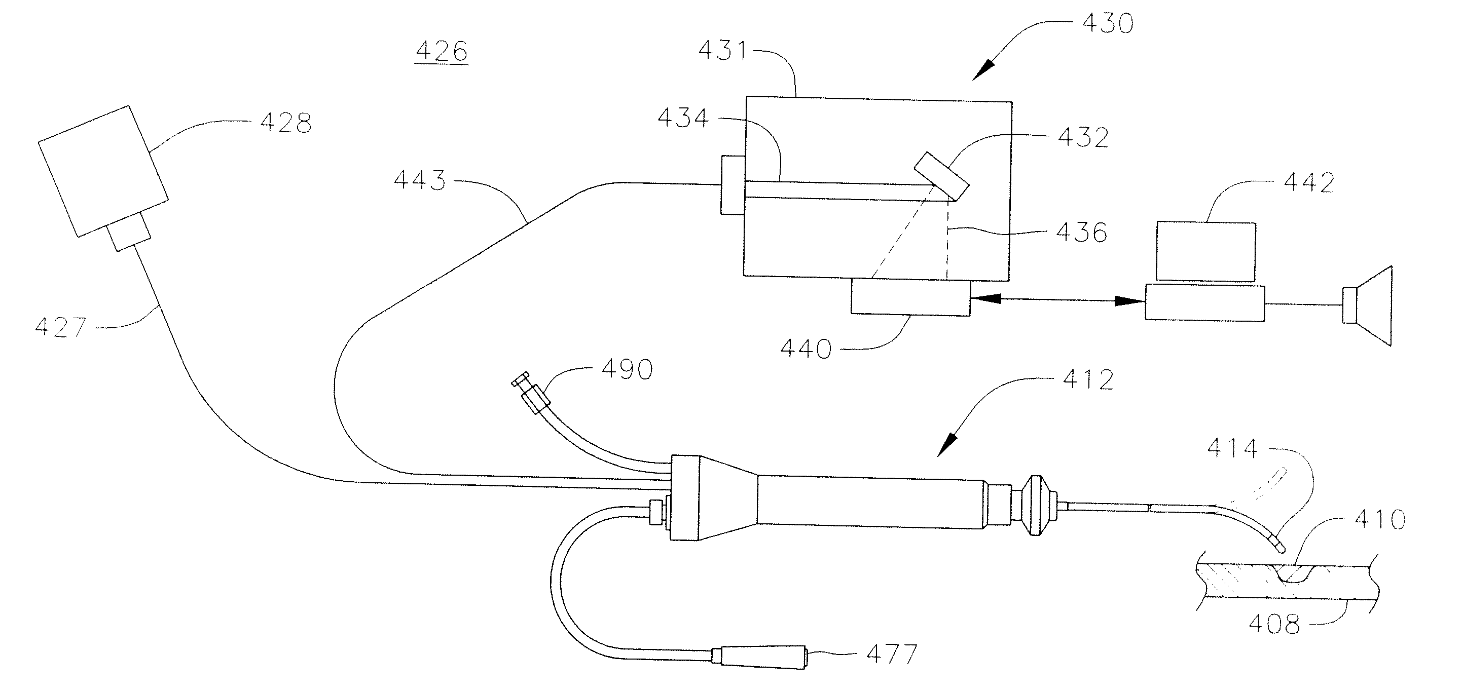 Apparatus and method for monitoring early formation of steam pop during ablation