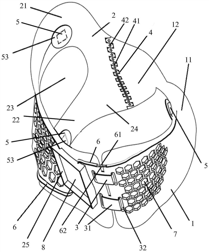 Intelligent pressure monitoring 3D printing scoliosis orthosis