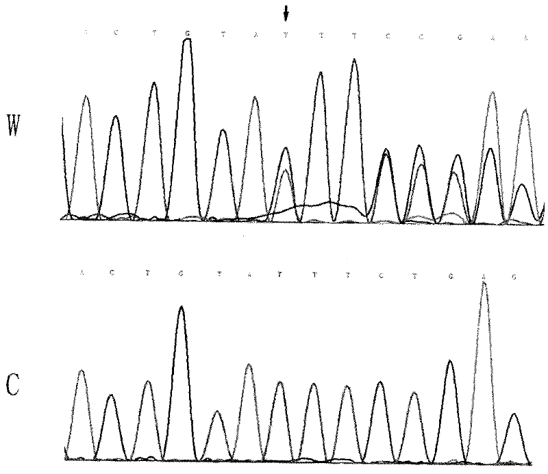 Gene diagnosis reagent kit for detecting adults progeria syndrome