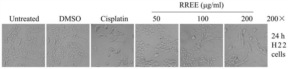 Alcohol extract of rhytidium rugosum, its preparation method and application in preparation of anti-liver cancer drugs