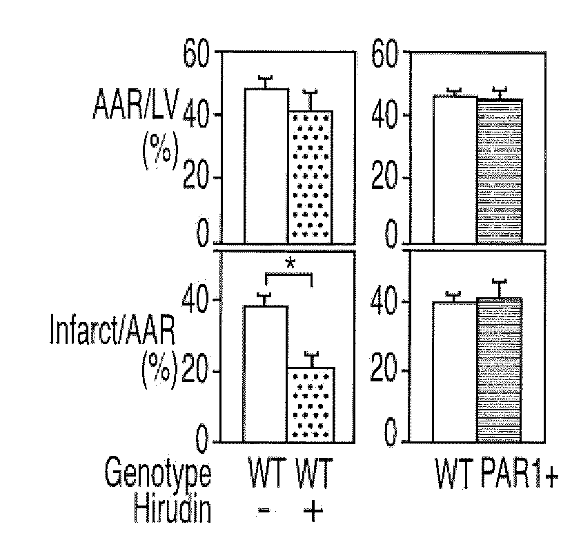 Methods and compositions for treating cardiac dysfunctions