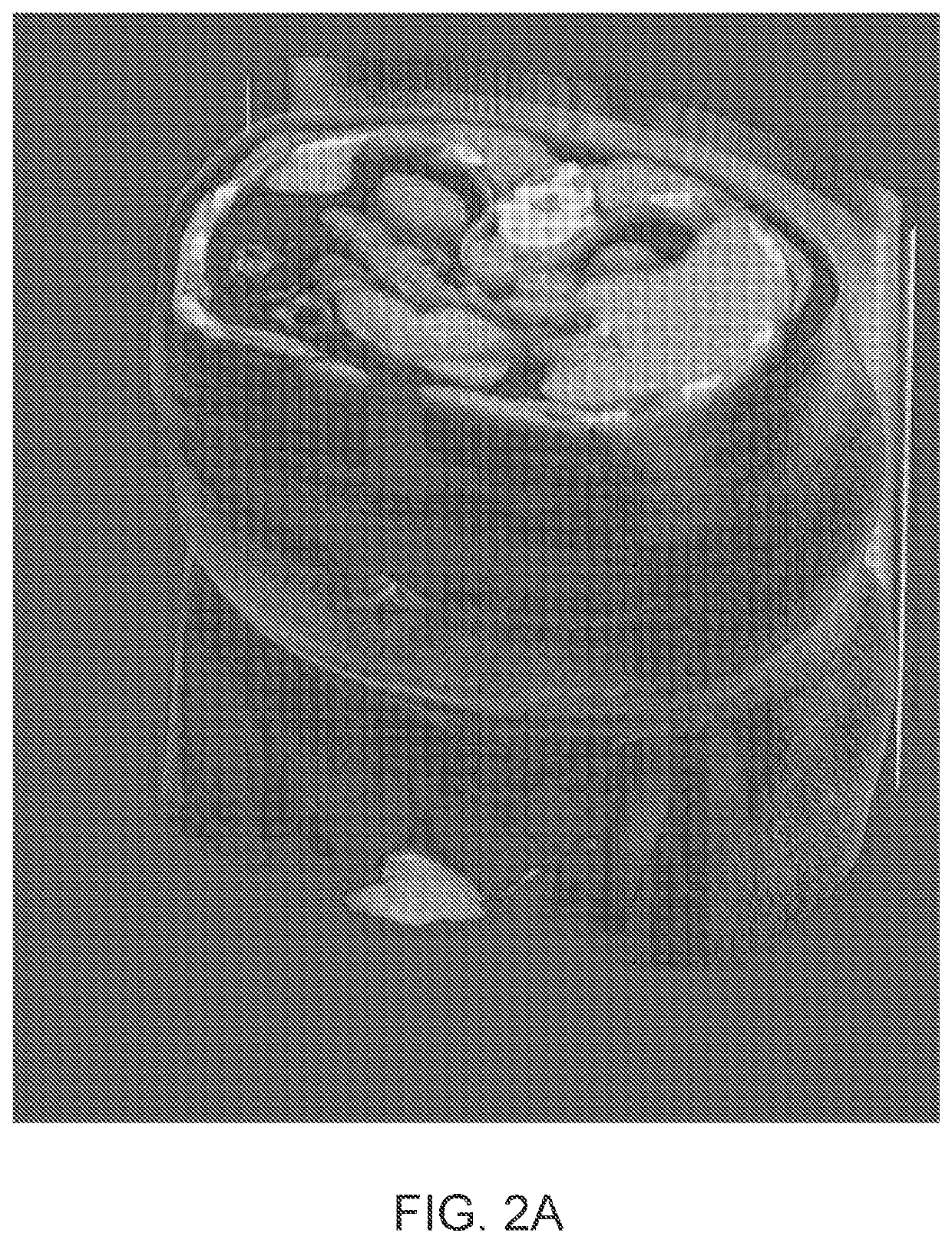 Systems and methods for rapid neural network-based image segmentation and radiopharmaceutical uptake determination