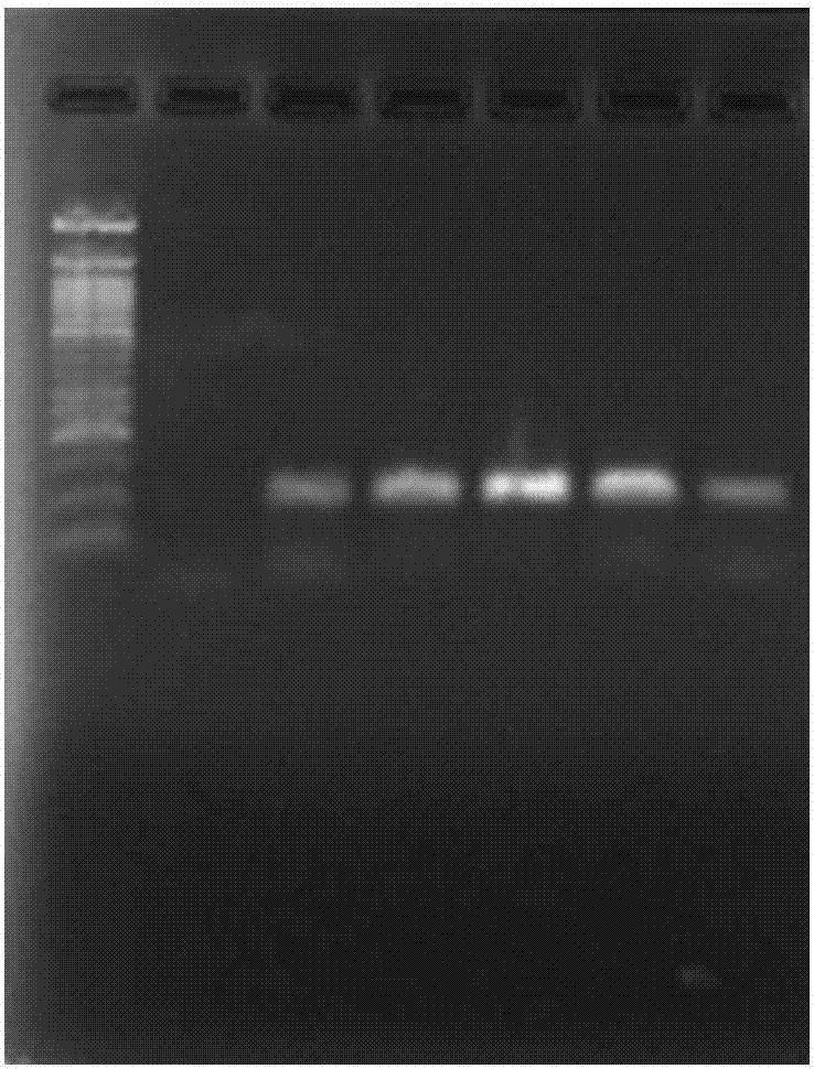 Kit for rapidly detecting nucleic acid of hepatitis C virus and detection method of kit