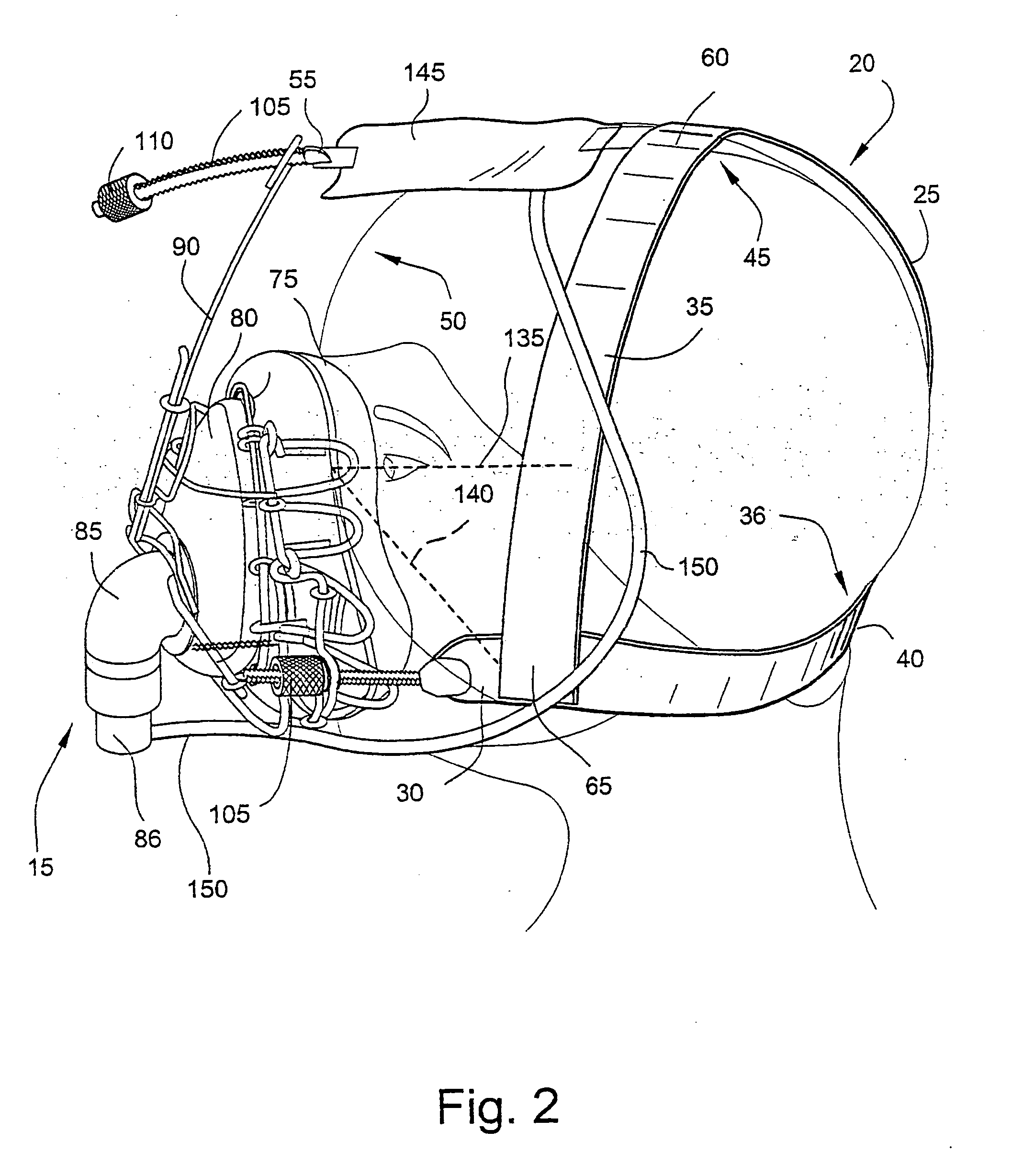 Mask and components thereof