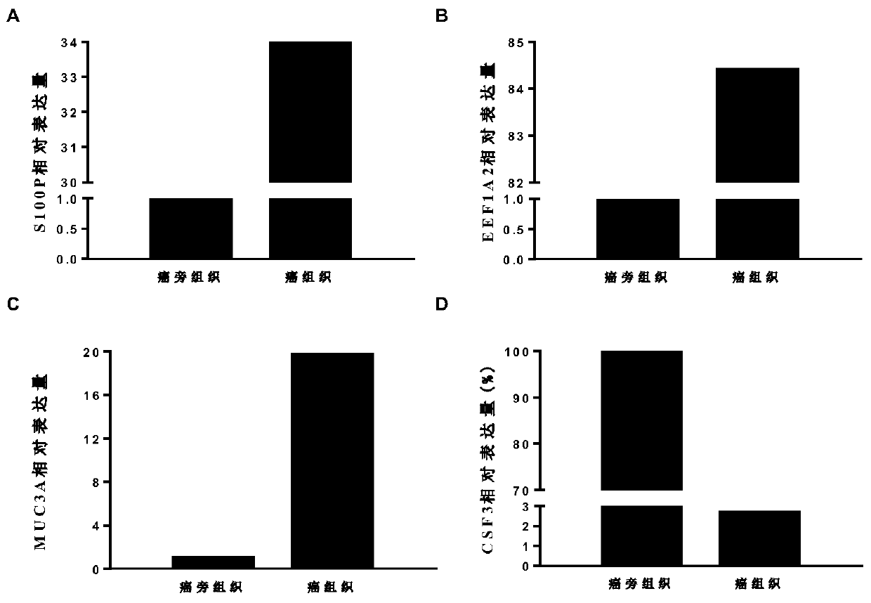 Application of biological marker to diagnosis of lung adenocarcinoma