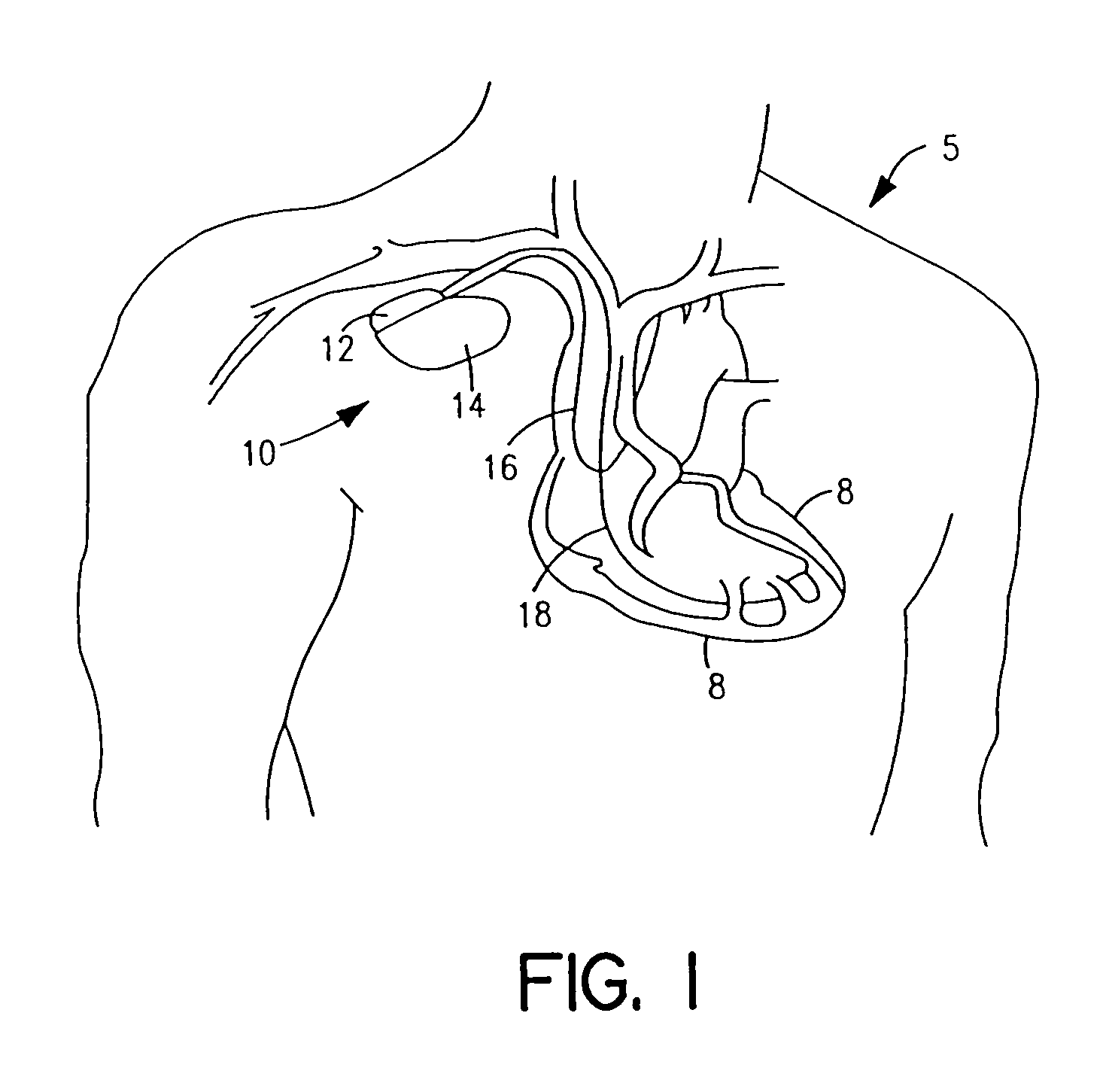 System and method for remote programming of an implantable medical device