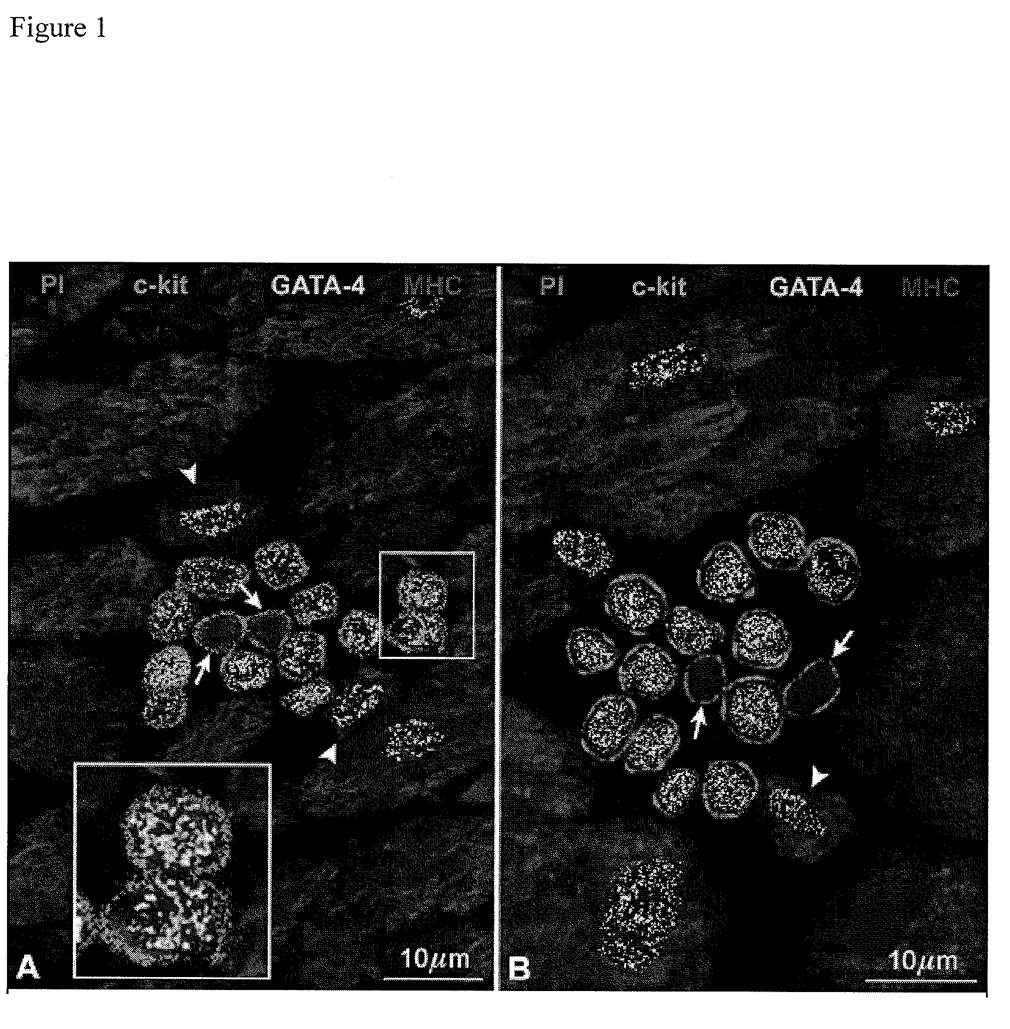 Methods of isolating non-senescent cardiac stem cells and uses thereof