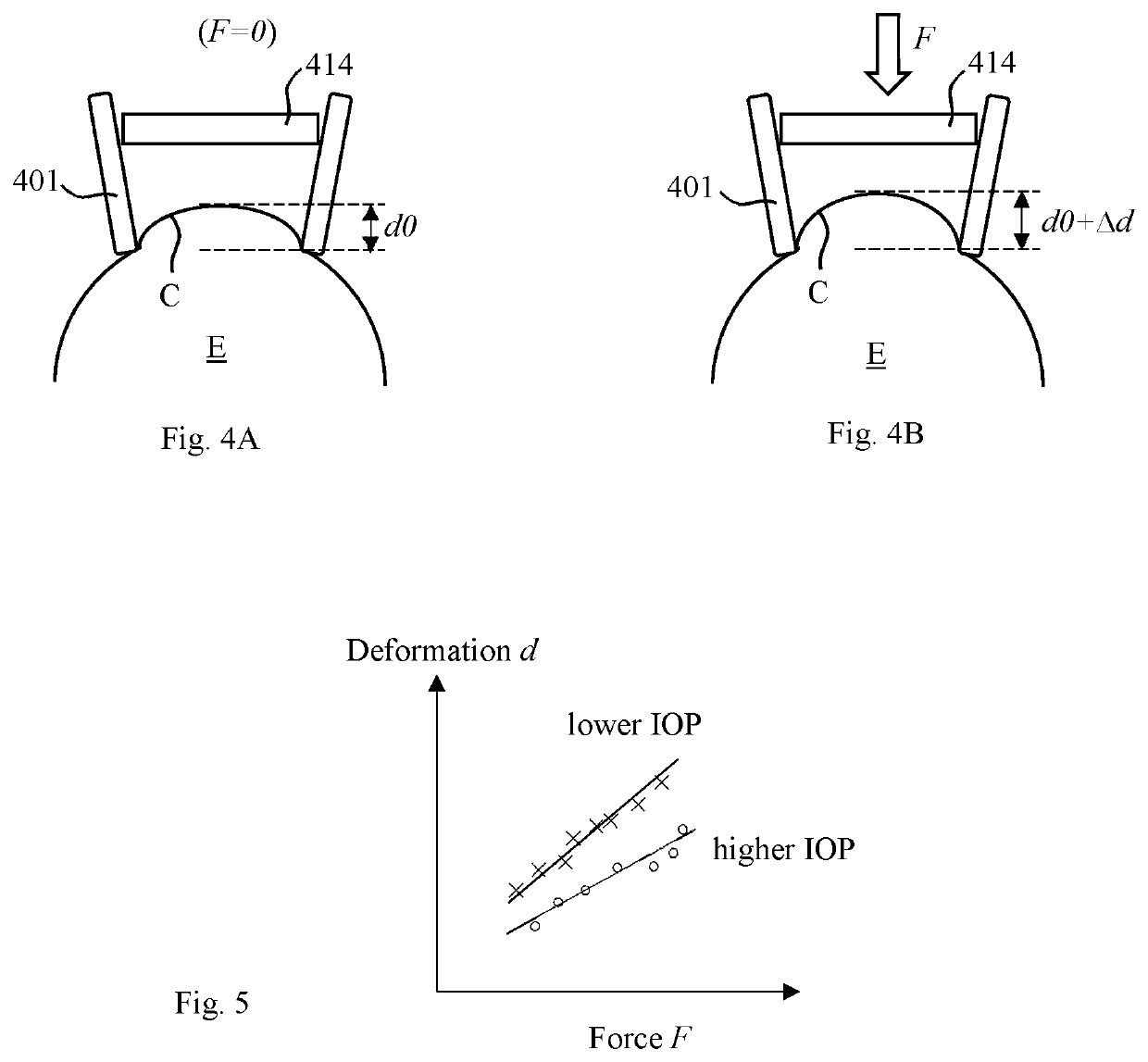 Intraocular pressure measurement for an eye docked to a laser system