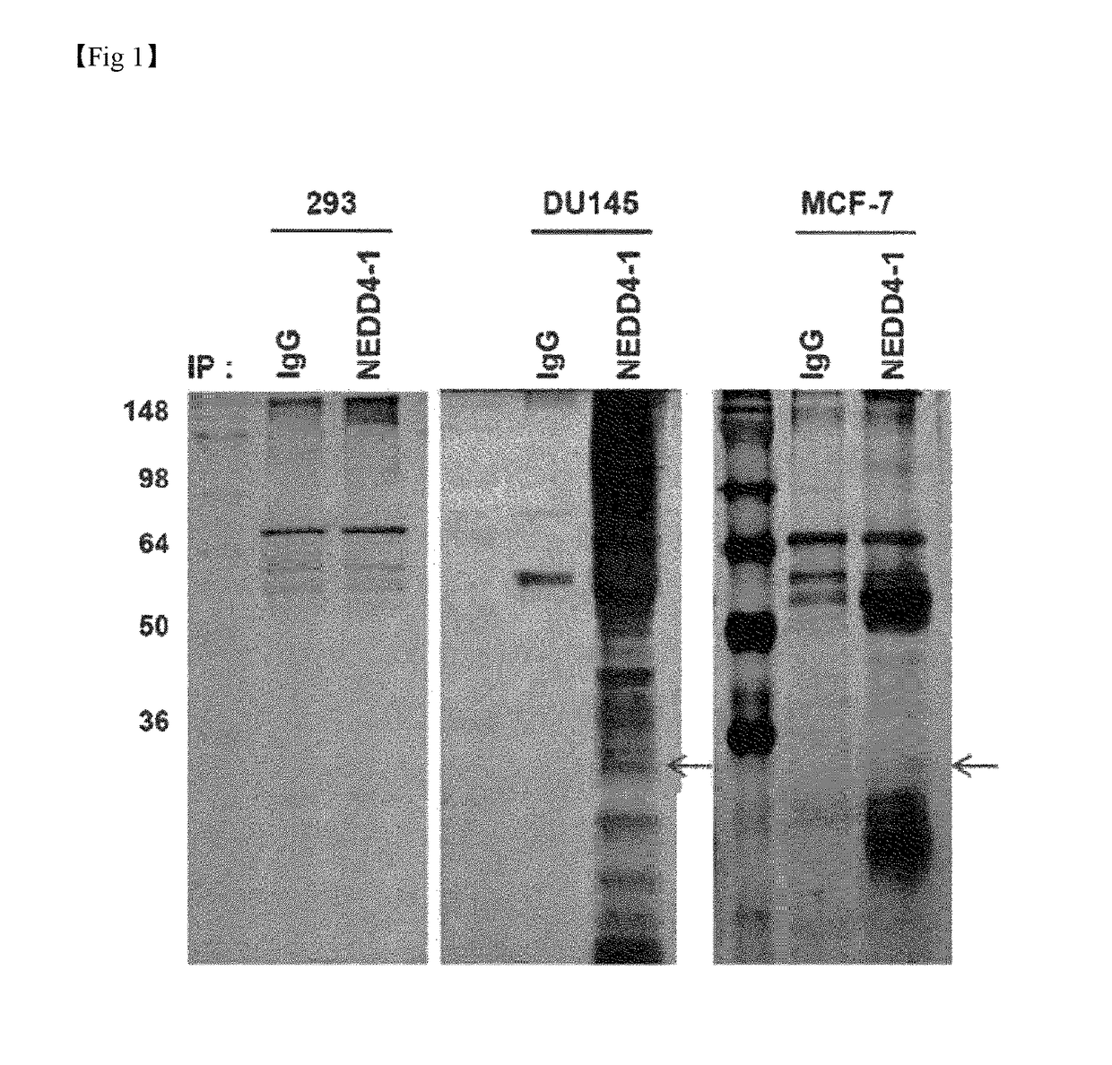 Composition for treatment or metastasis suppression of cancers which includes p34 expression inhibitor or activity inhibitor as active ingredient